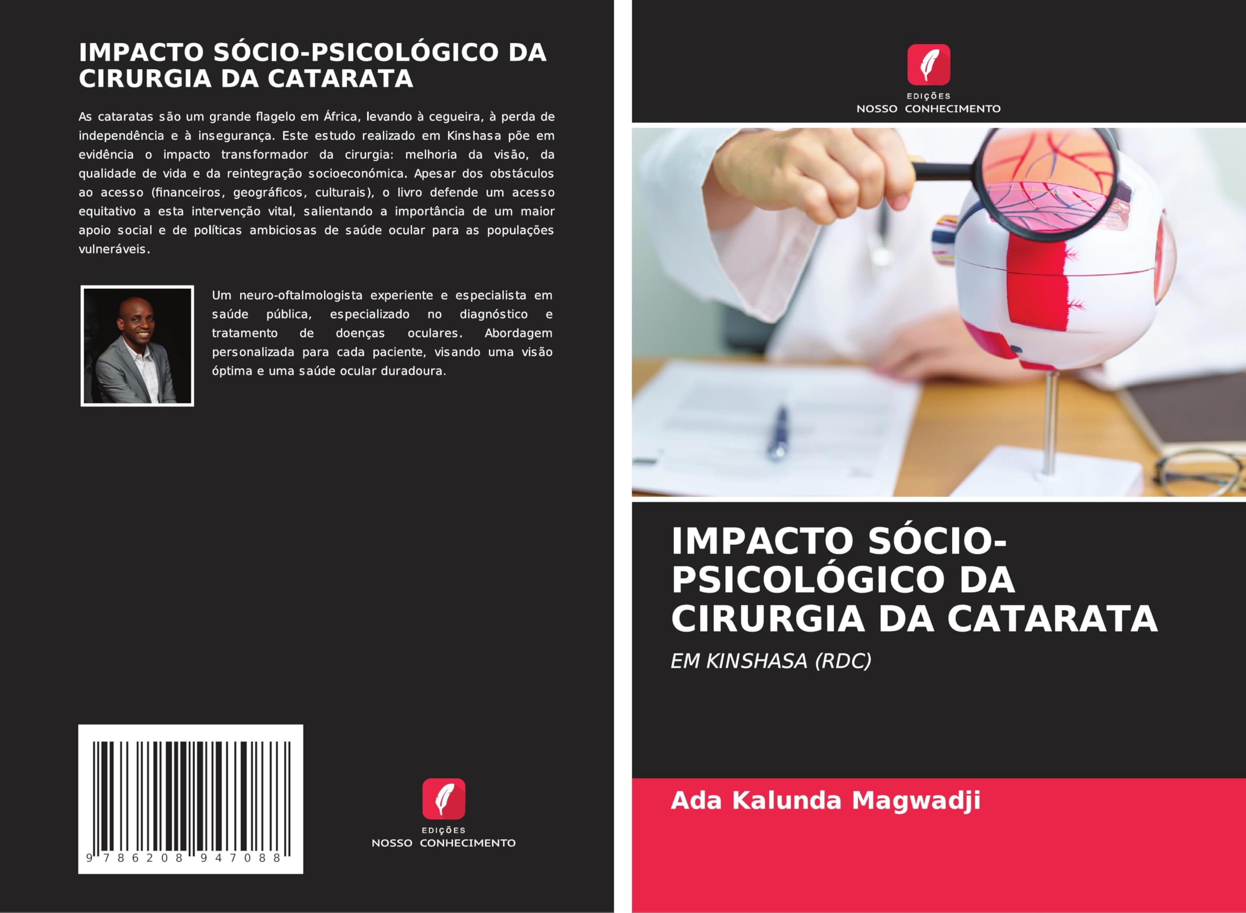 IMPACTO SÓCIO-PSICOLÓGICO DA CIRURGIA DA CATARATA Medicine
