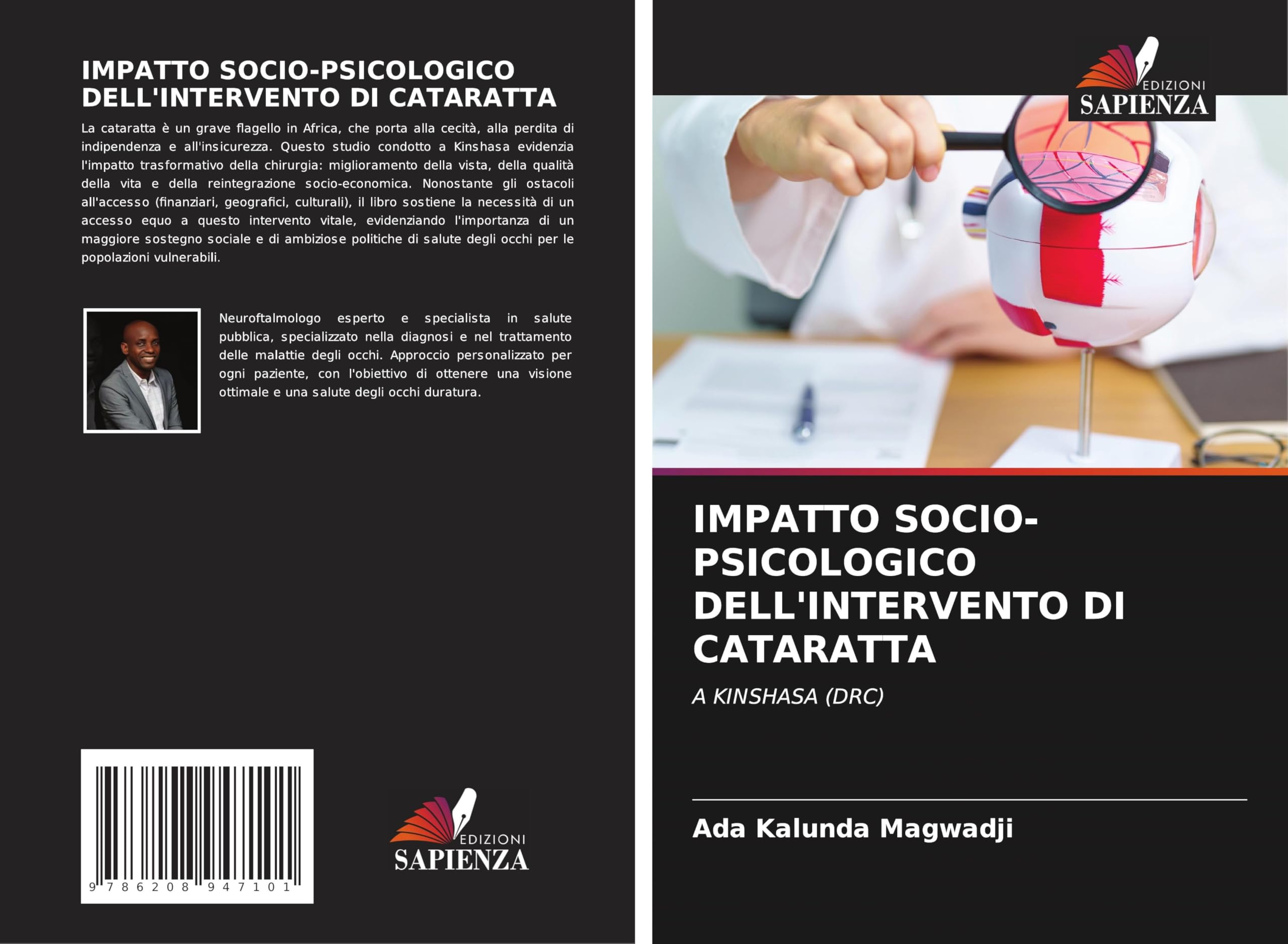 IMPATTO SOCIO-PSICOLOGICO DELL'INTERVENTO DI CATARATTA Medicine