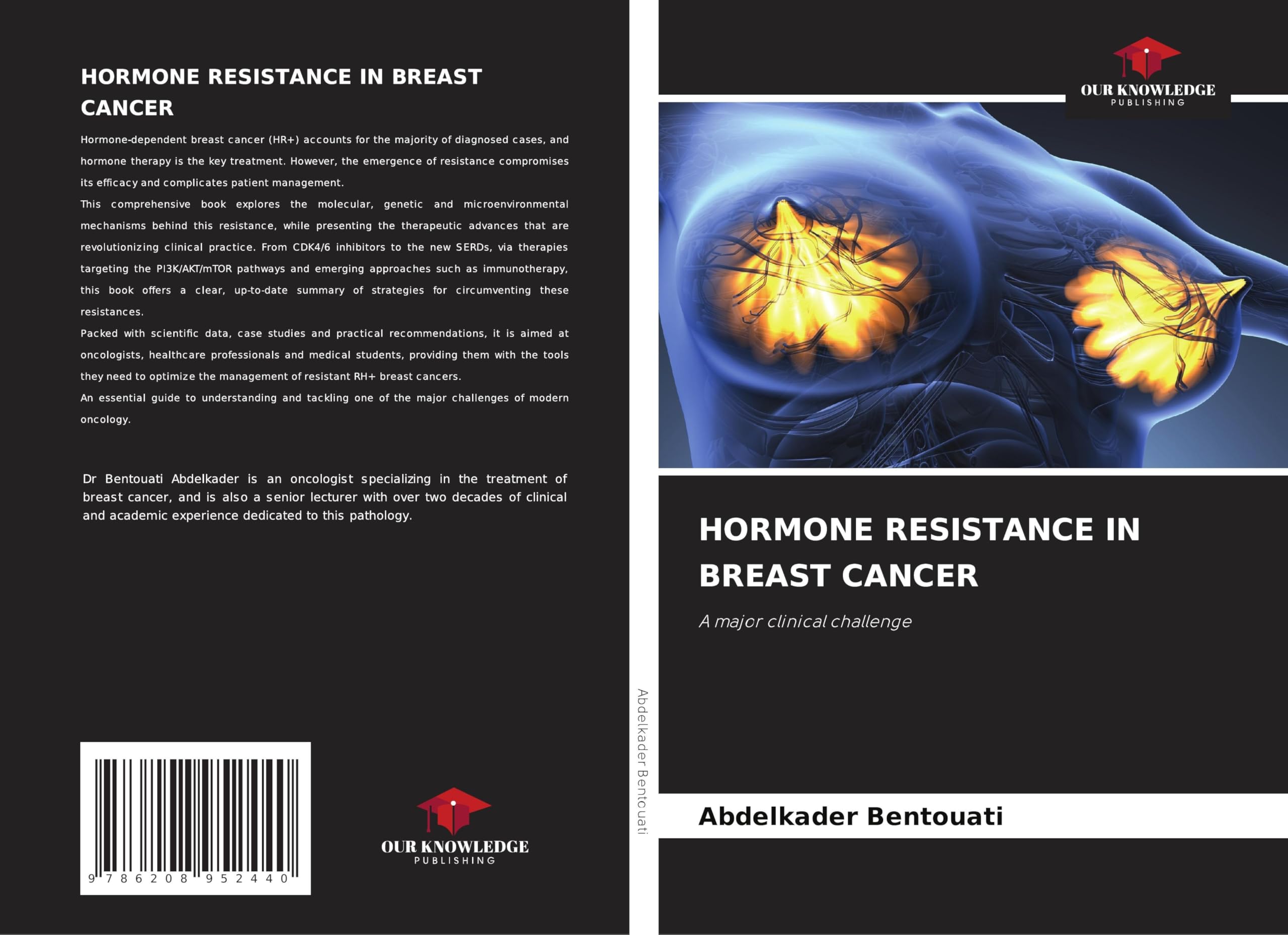 HORMONE RESISTANCE IN BREAST CANCER Medicine