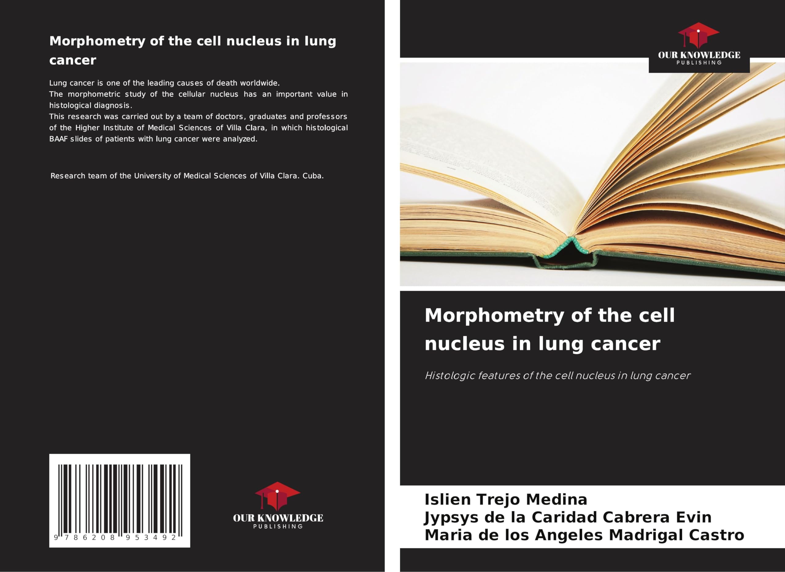 Morphometry of the cell nucleus in lung cancer Medicine