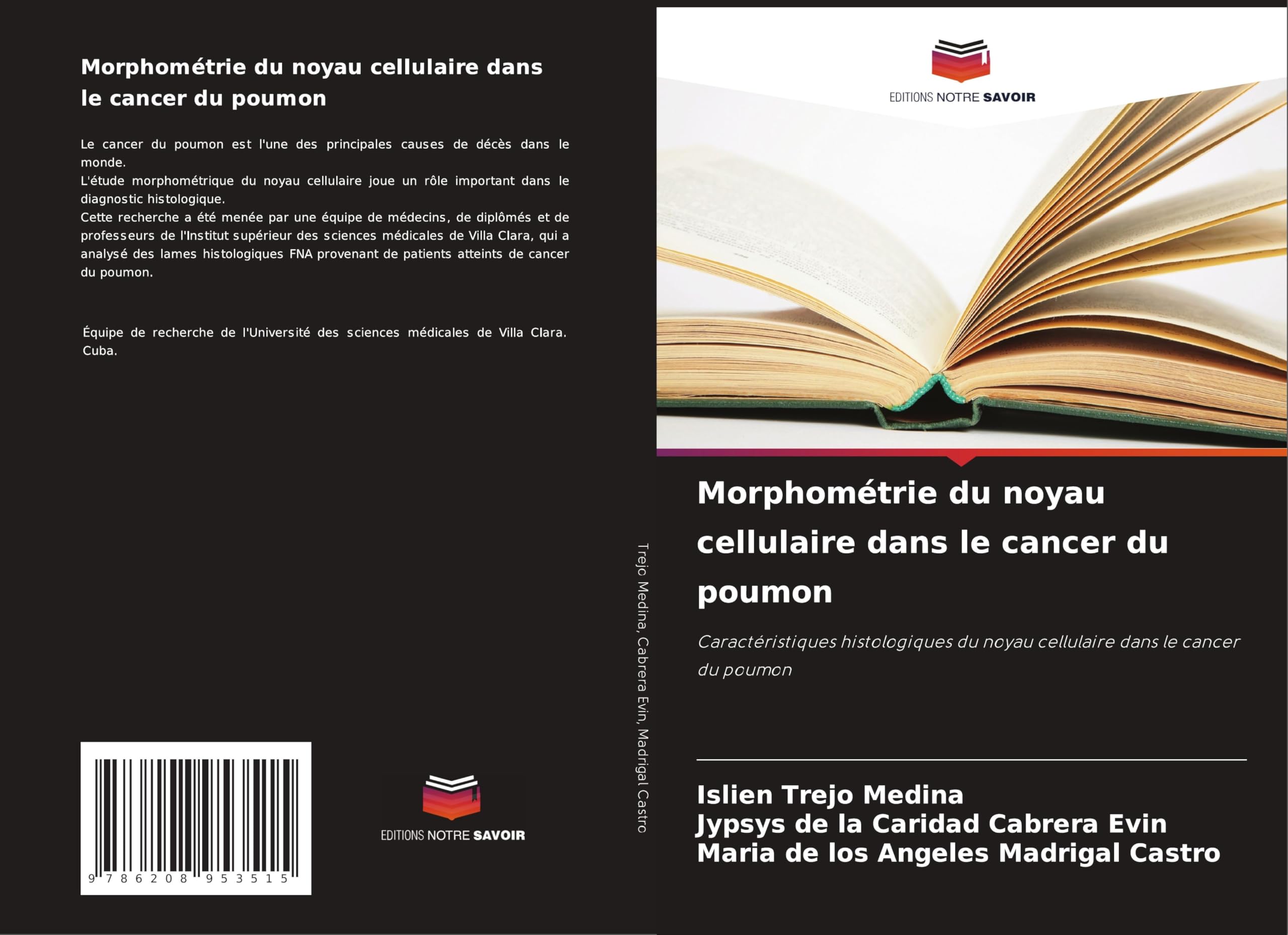 Morphométrie du noyau cellulaire dans le cancer du poumon Medicine