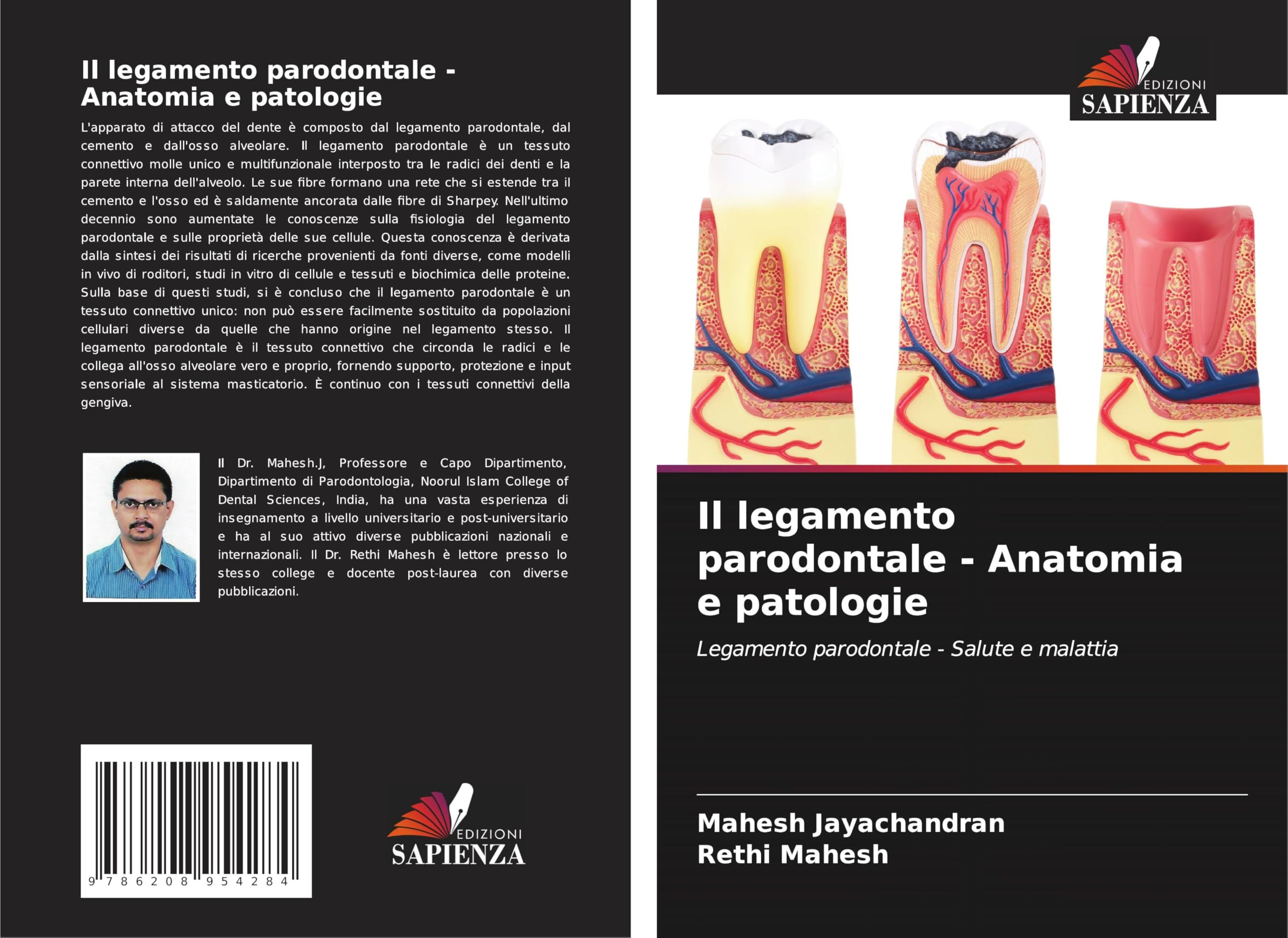 Il legamento parodontale - Anatomia e patologie Medicine