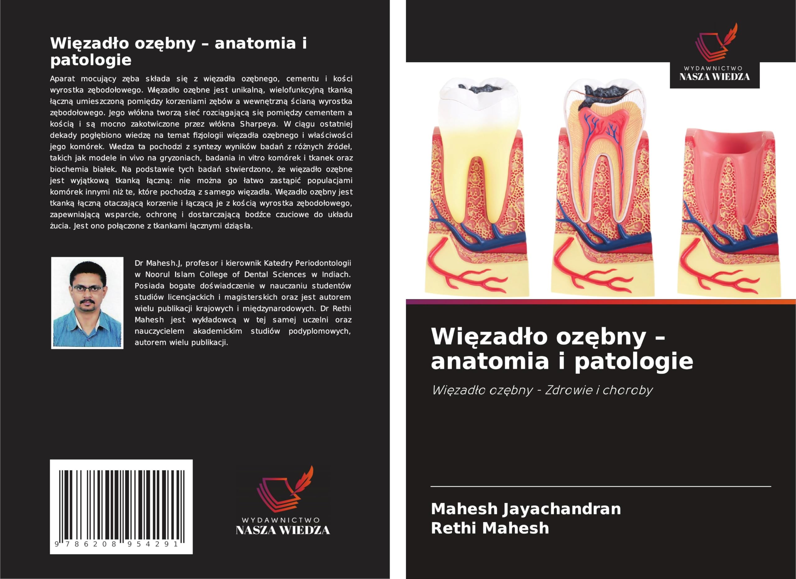 Wi¿zad¿o oz¿bny - anatomia i patologie Medicine
