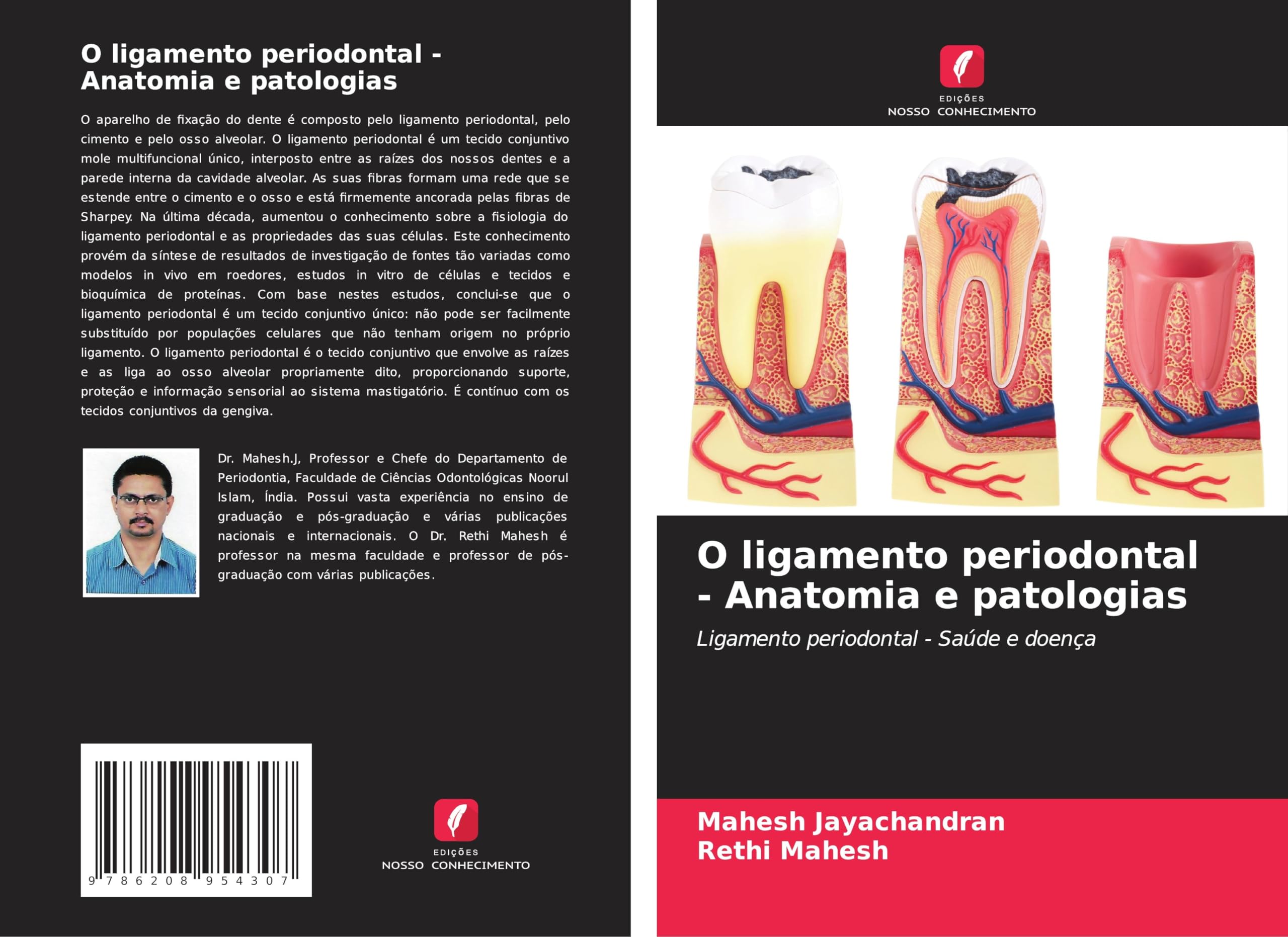 O ligamento periodontal - Anatomia e patologias Medicine