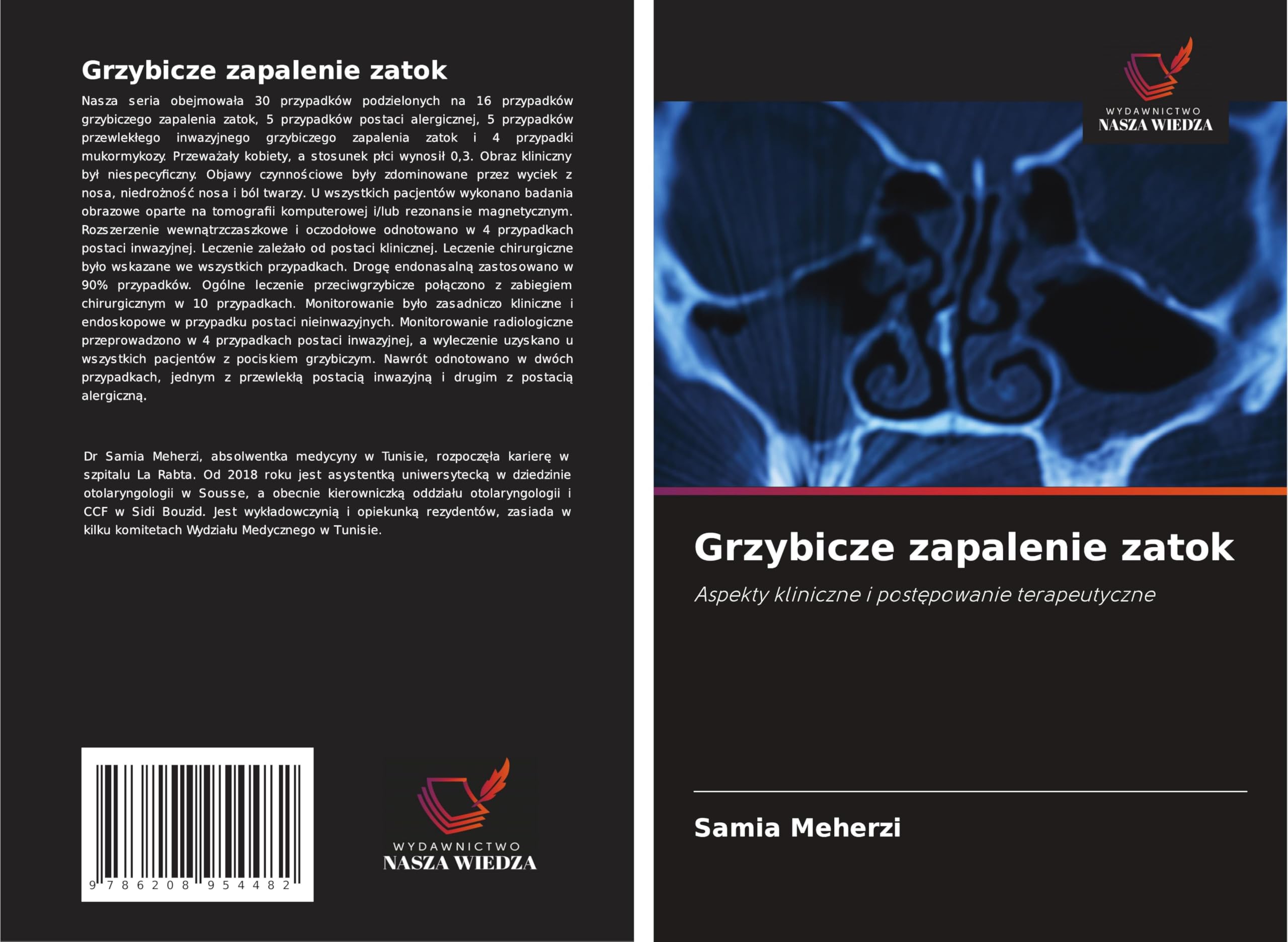 Grzybicze zapalenie zatok Medicine