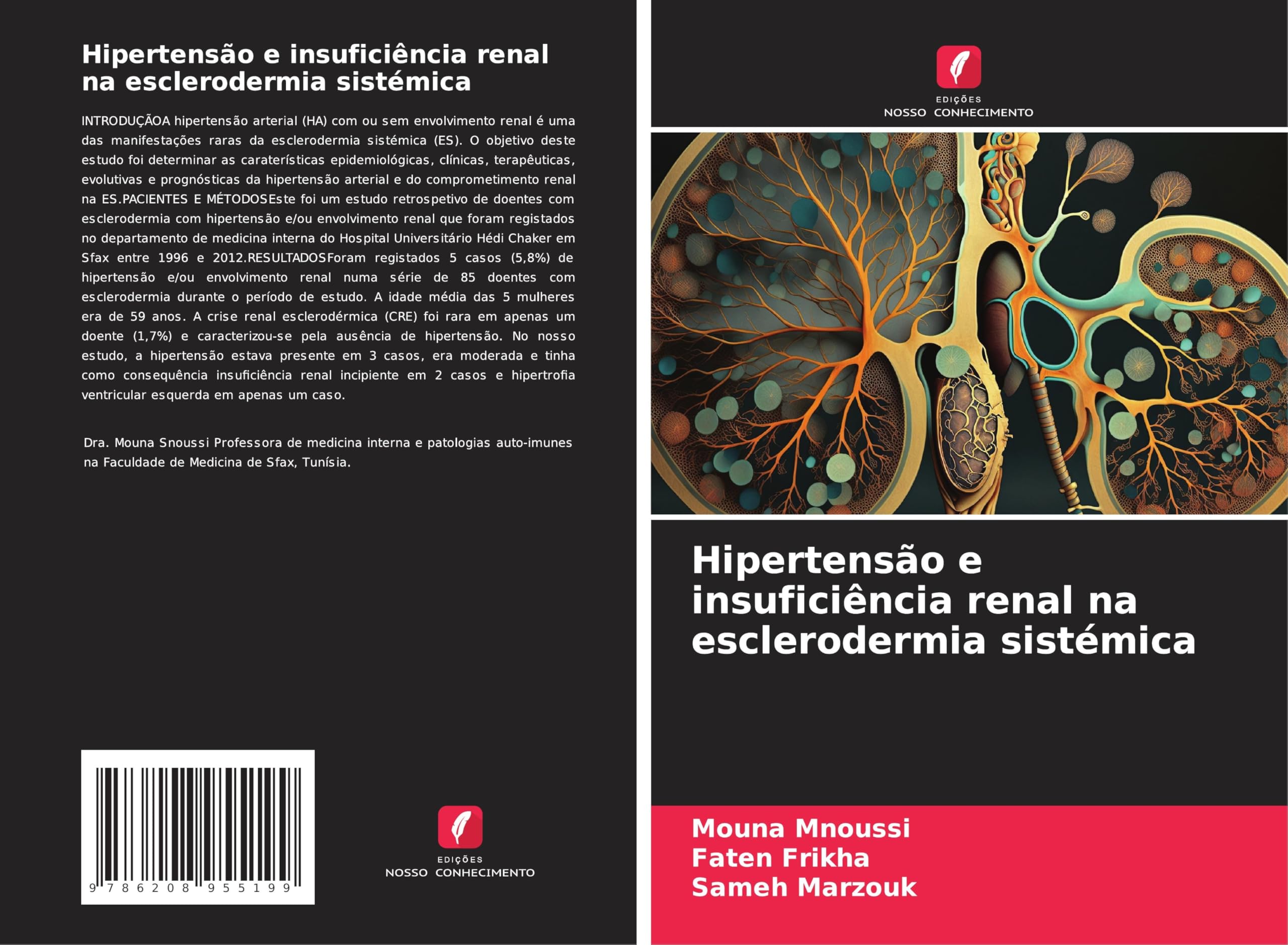 Hipertensão e insuficiência renal na esclerodermia sistémica Medicine