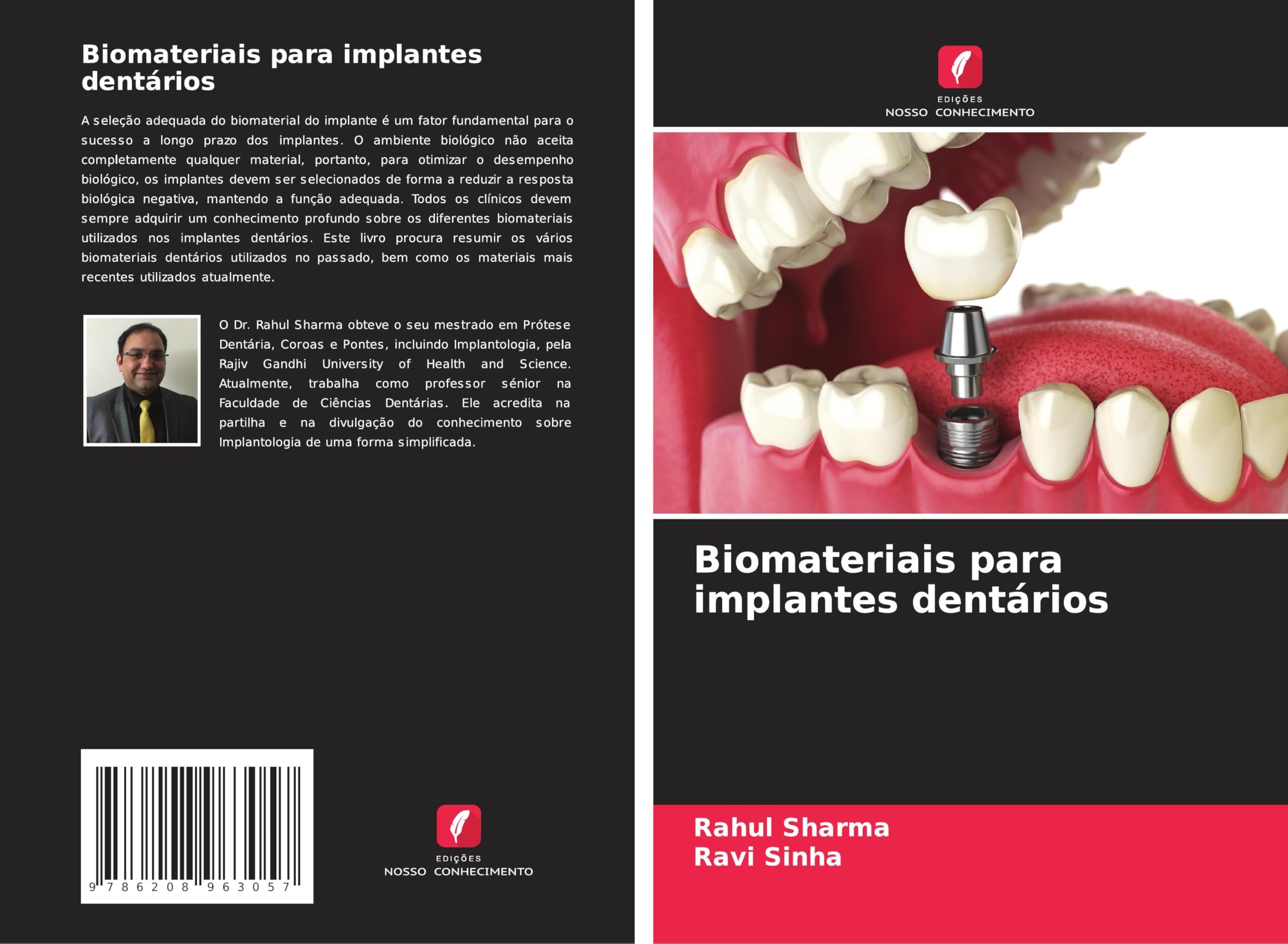 Biomateriais para implantes dentários Medicine