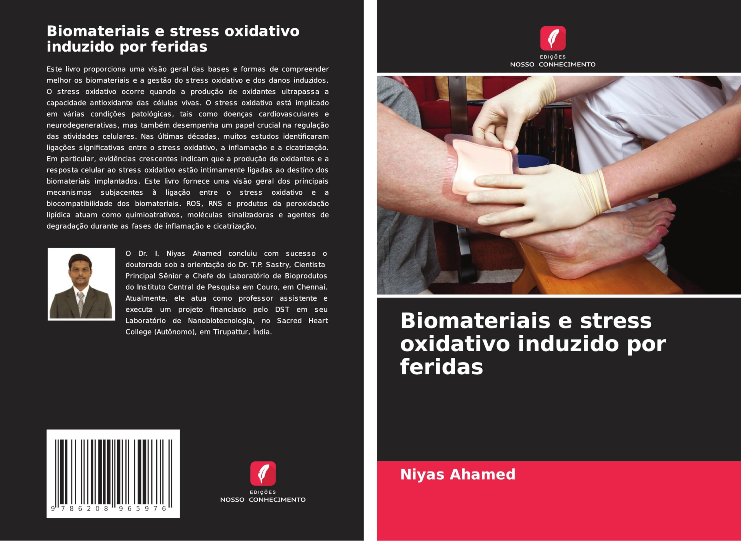 Biomateriais e stress oxidativo induzido por feridas Medicine