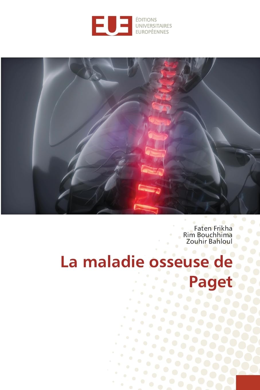 La maladie osseuse de Paget Medicine