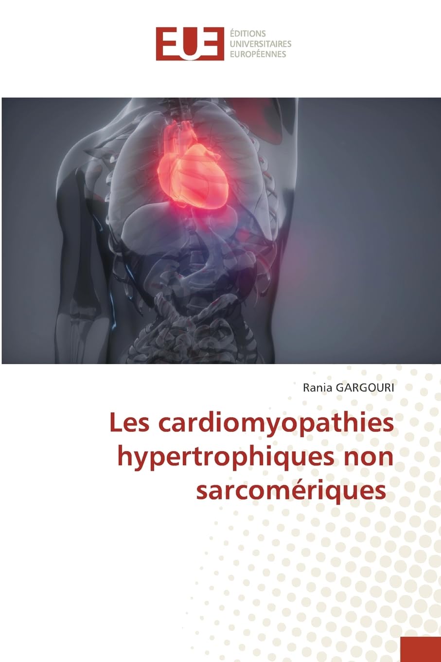 Les cardiomyopathies hypertrophiques non sarcomériques Medicine