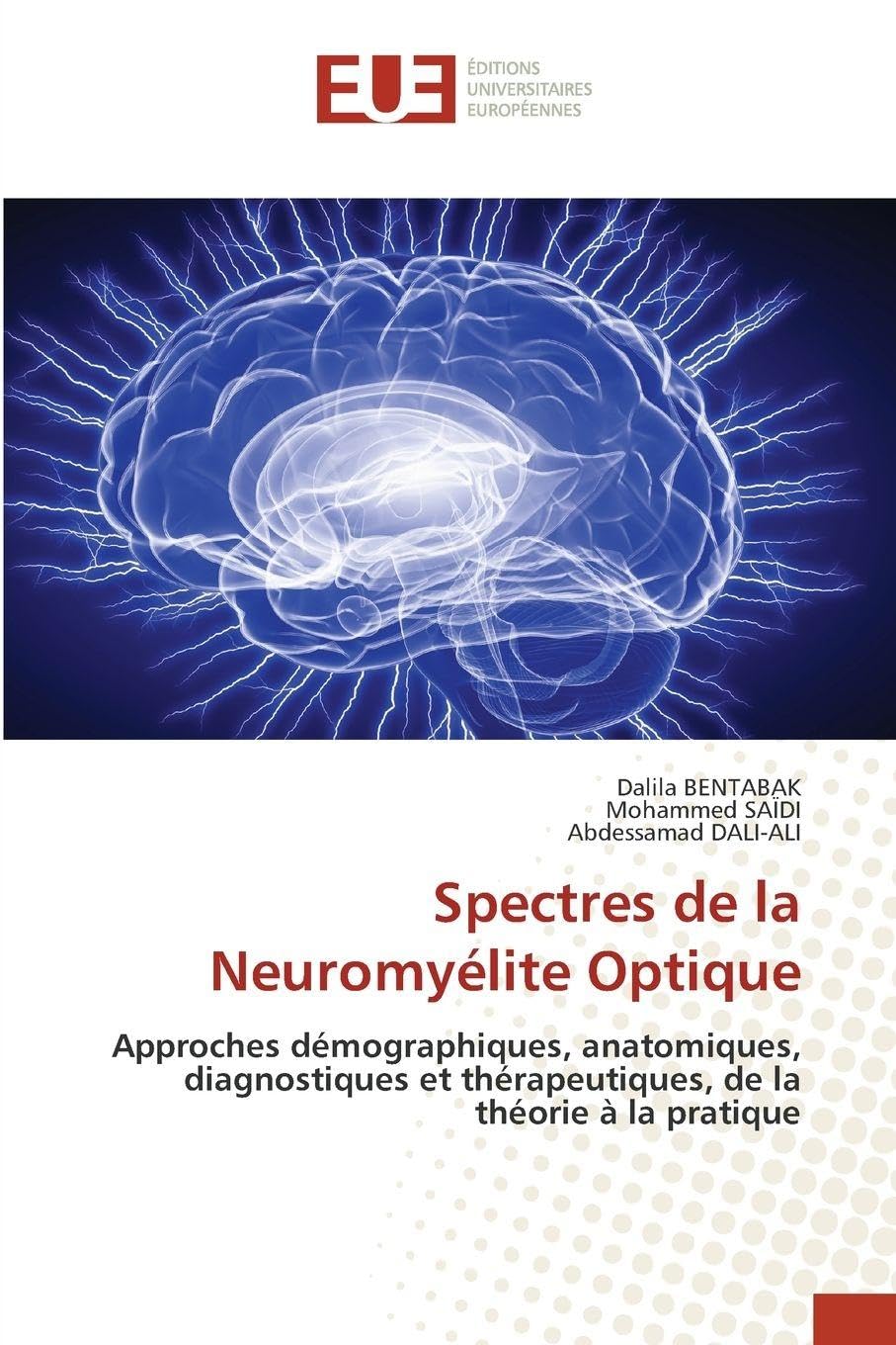 Spectres de la Neuromyélite Optique: Approches démographiques, anatomiques, diagnostiques et thérapeutiques, de la théorie à la pratique Medicine
