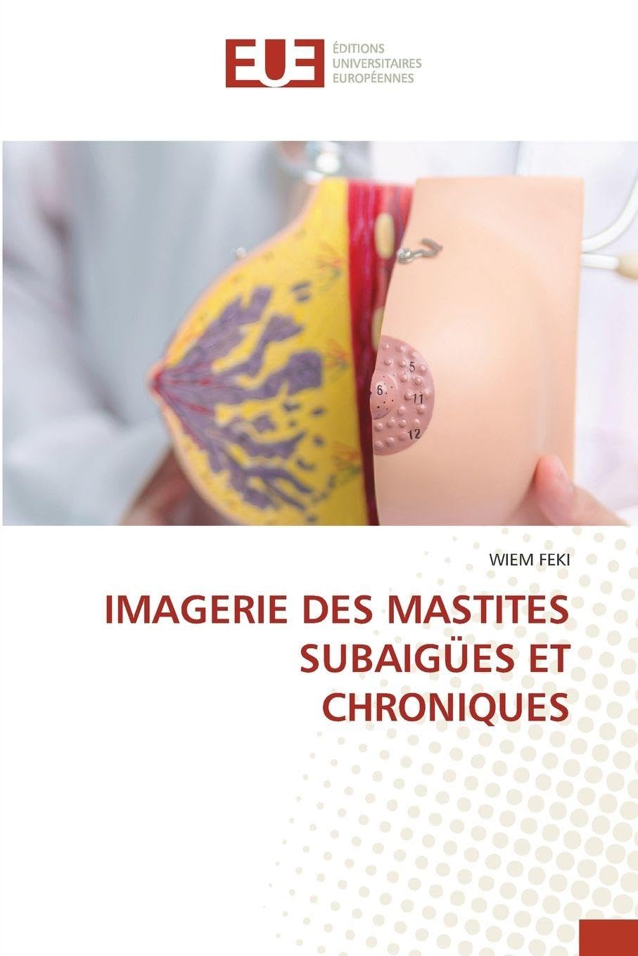 IMAGERIE DES MASTITES SUBAIGÜES ET CHRONIQUES Books