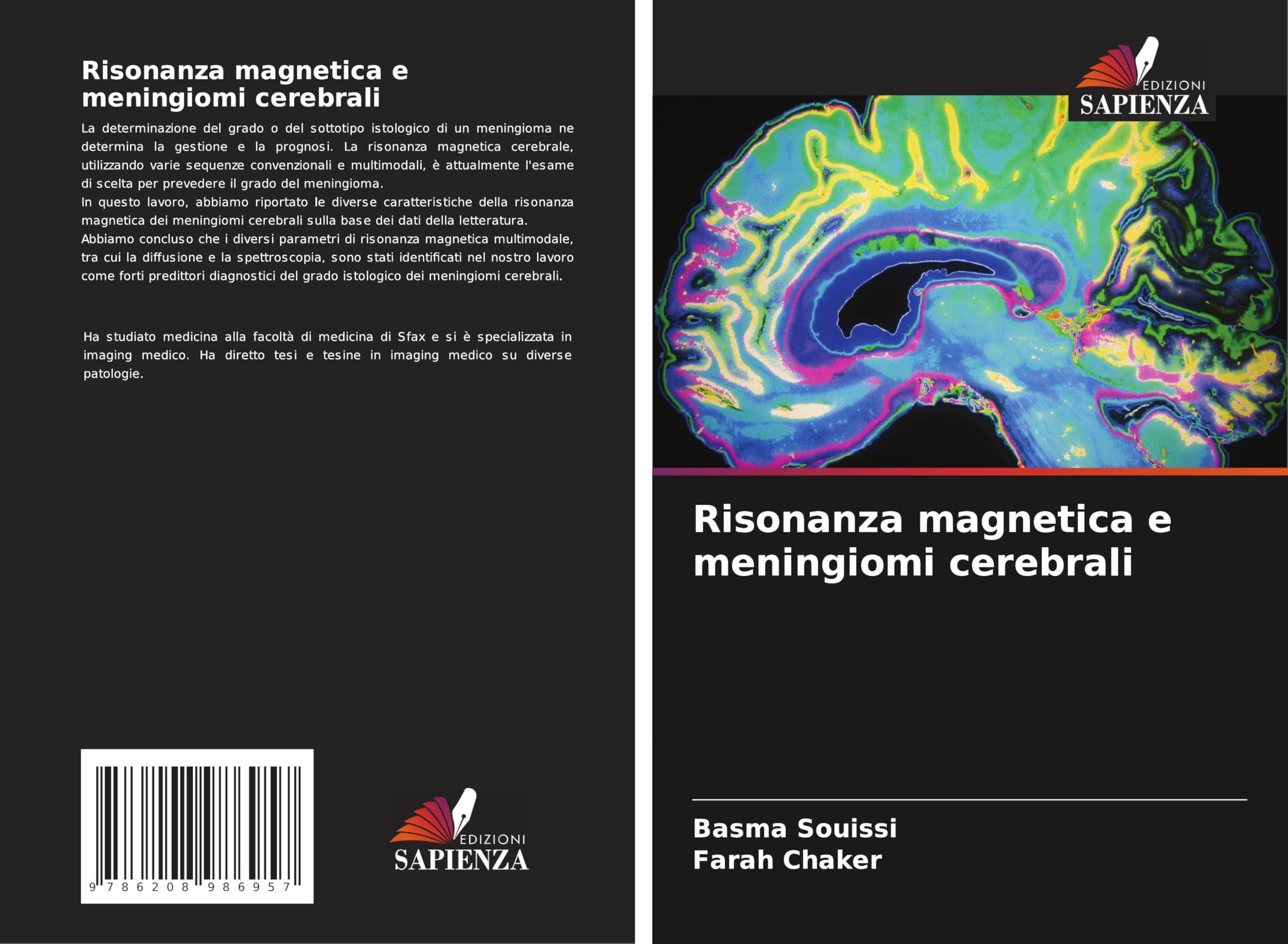 Risonanza magnetica e meningiomi cerebrali Law