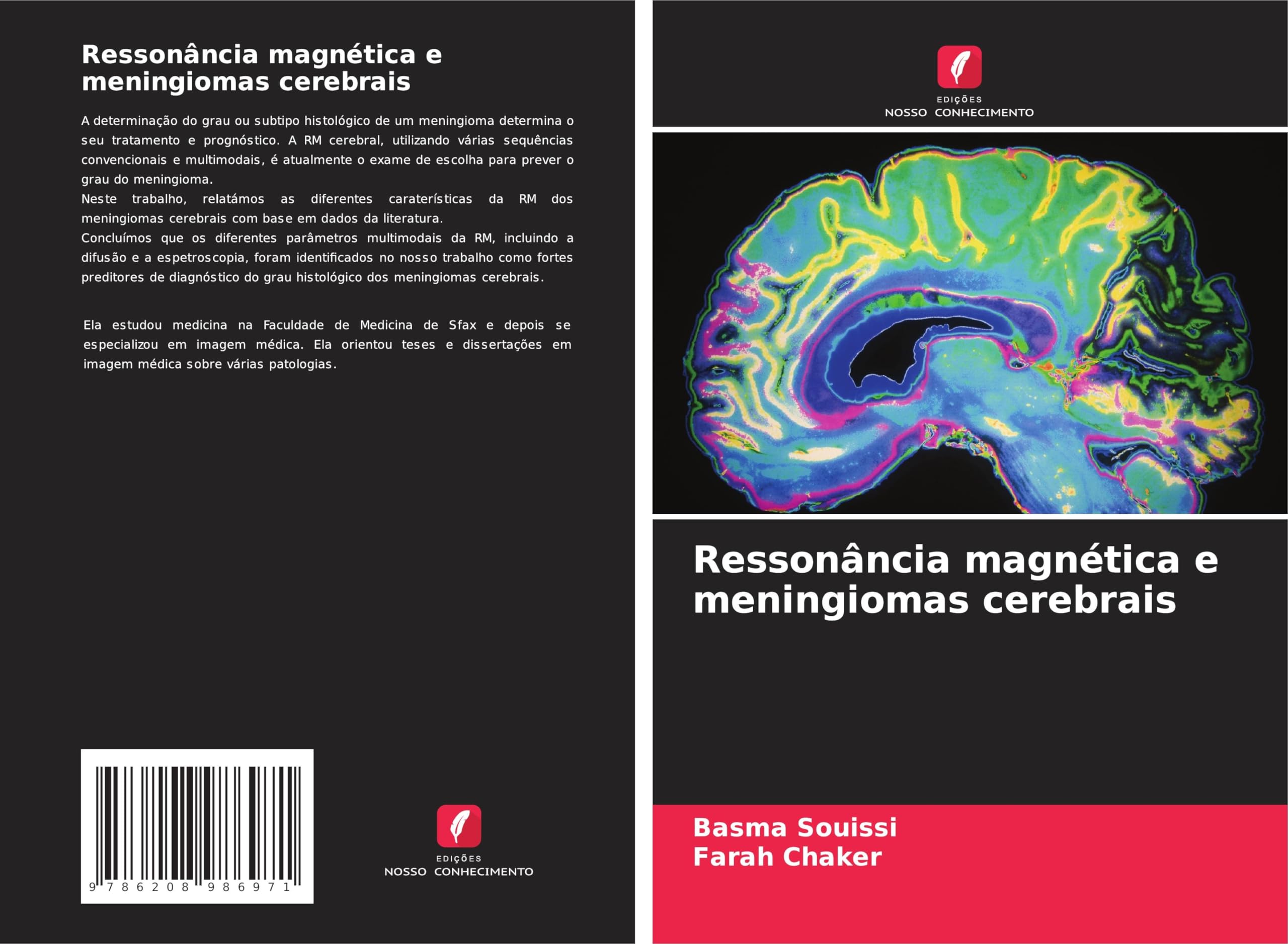 Ressonância magnética e meningiomas cerebrais Law