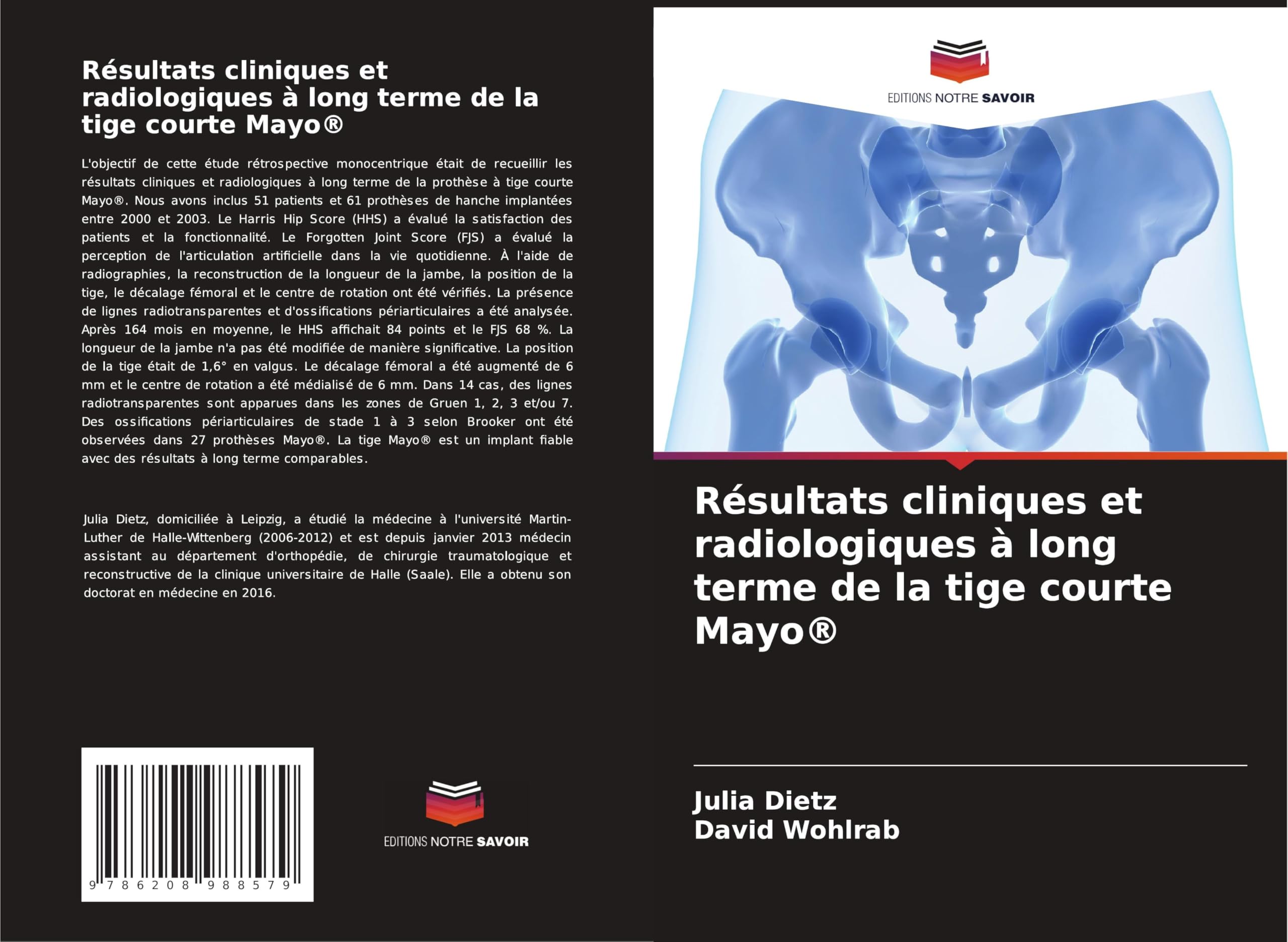Résultats cliniques et radiologiques à long terme de la tige courte Mayo® Medicine