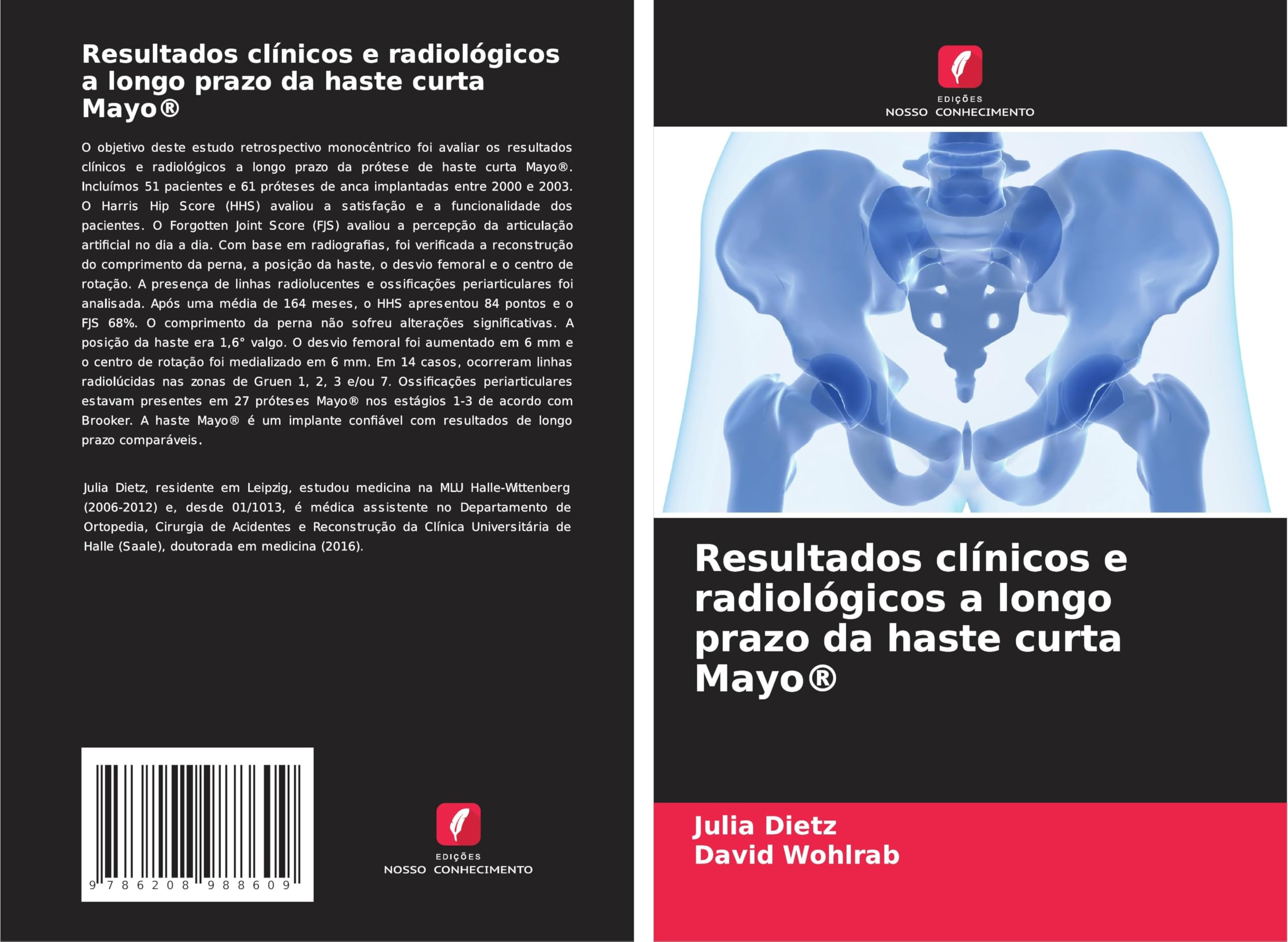 Resultados clínicos e radiológicos a longo prazo da haste curta Mayo® Medicine