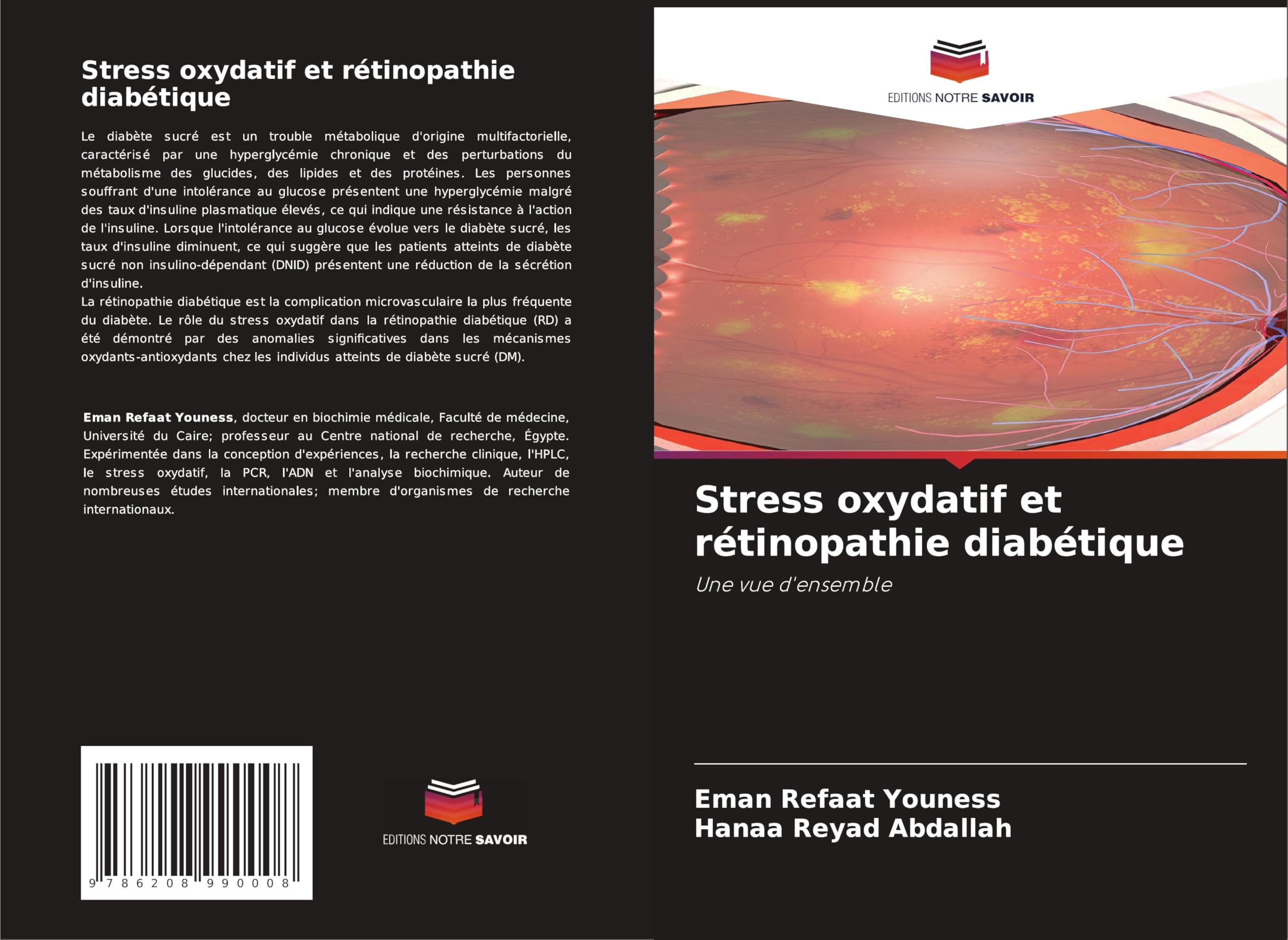 Stress oxydatif et rétinopathie diabétique Business & Technology