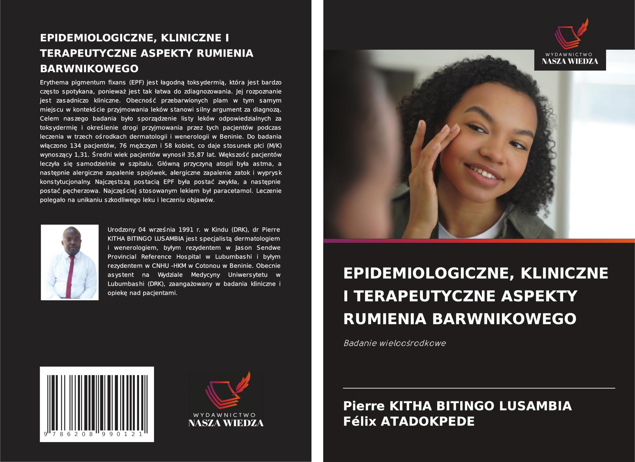 EPIDEMIOLOGICZNE, KLINICZNE I TERAPEUTYCZNE ASPEKTY RUMIENIA BARWNIKOWEGO Medicine