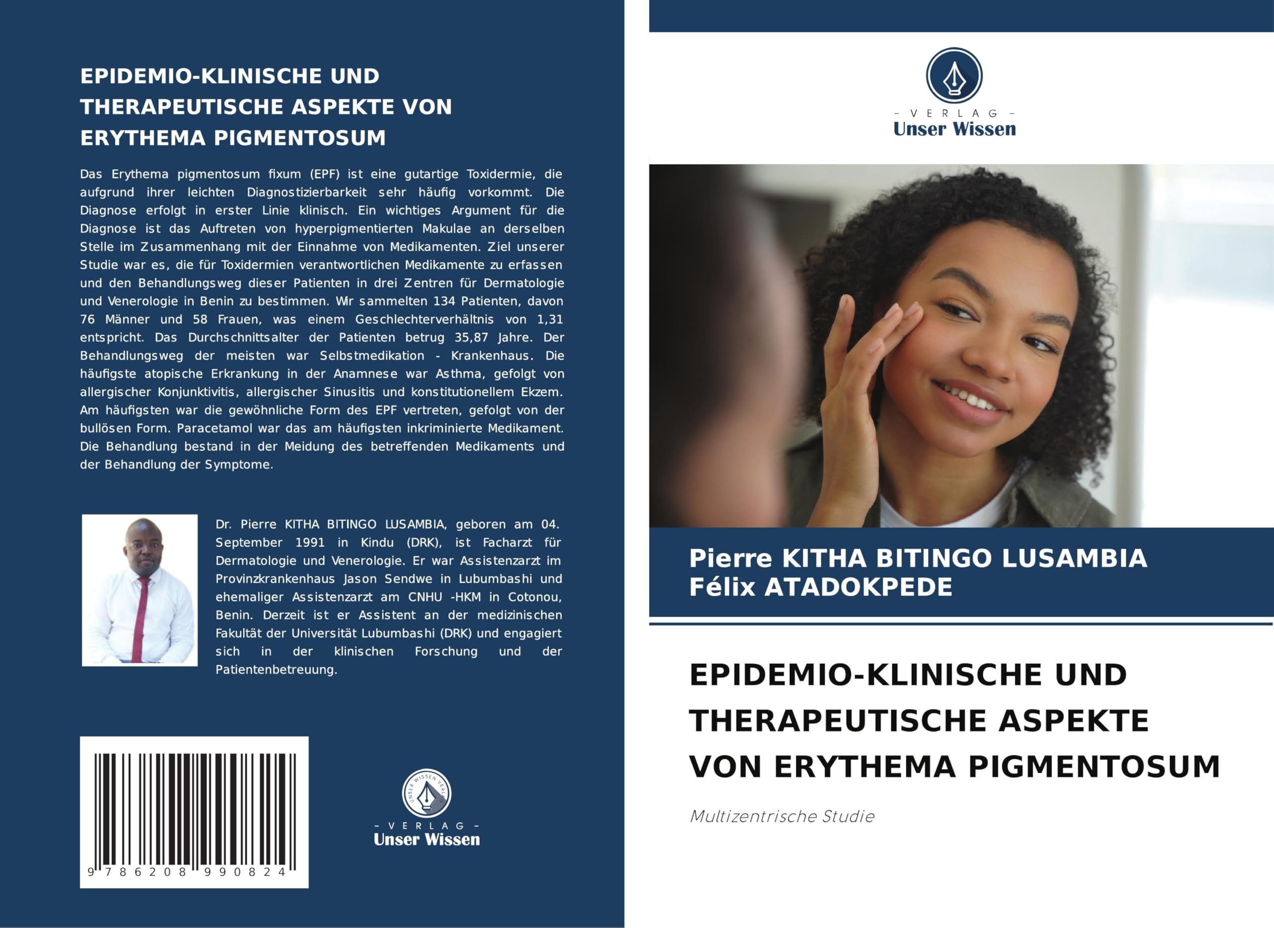 EPIDEMIO-KLINISCHE UND THERAPEUTISCHE ASPEKTE VON ERYTHEMA PIGMENTOSUM Medicine