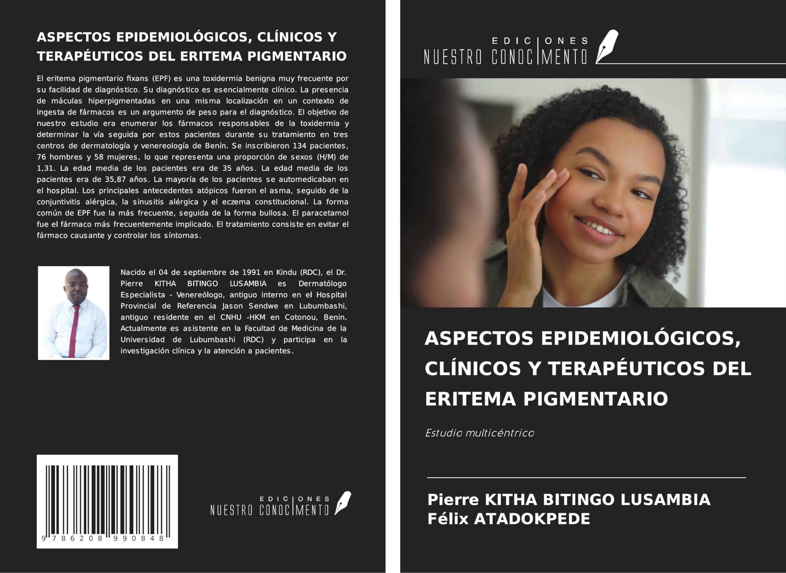ASPECTOS EPIDEMIOLÓGICOS, CLÍNICOS Y TERAPÉUTICOS DEL ERITEMA PIGMENTARIO Medicine