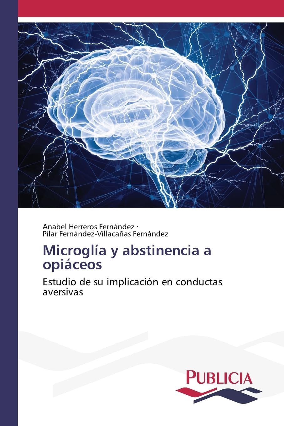 Microglía y abstinencia a opiáceos Law