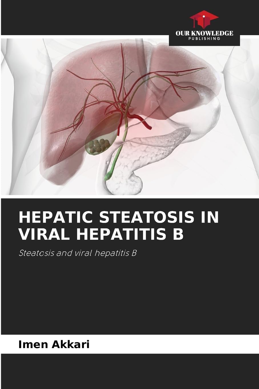 HEPATIC STEATOSIS IN VIRAL HEPATITIS B Medicine