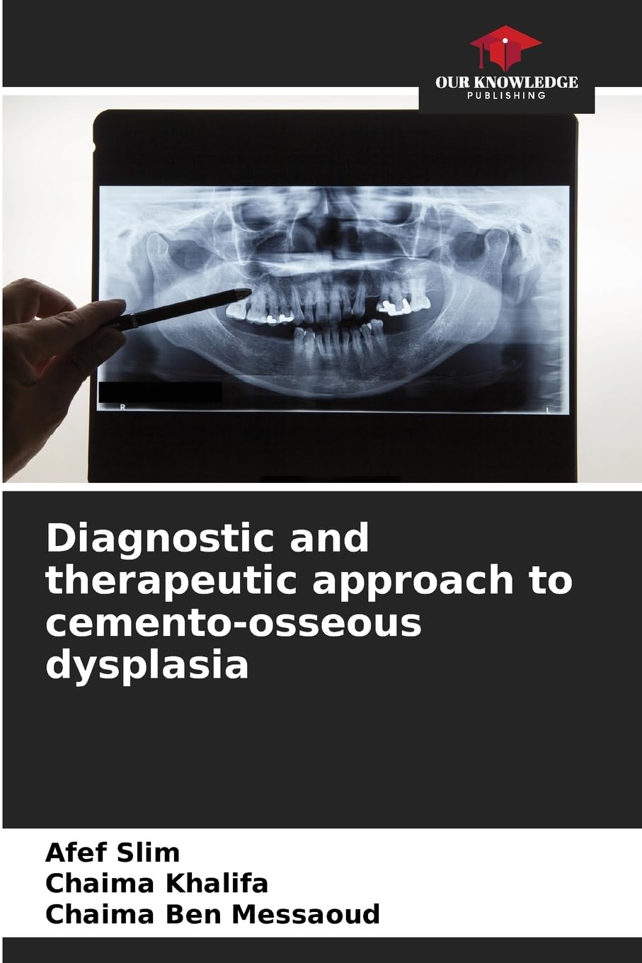 Diagnostic and therapeutic approach to cemento-osseous dysplasia Medicine