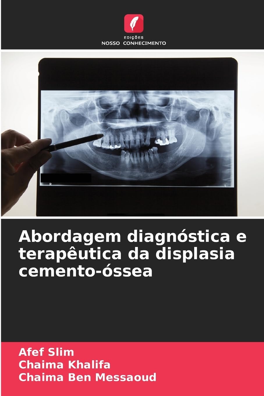 Abordagem diagnóstica e terapêutica da displasia cemento-óssea Medicine