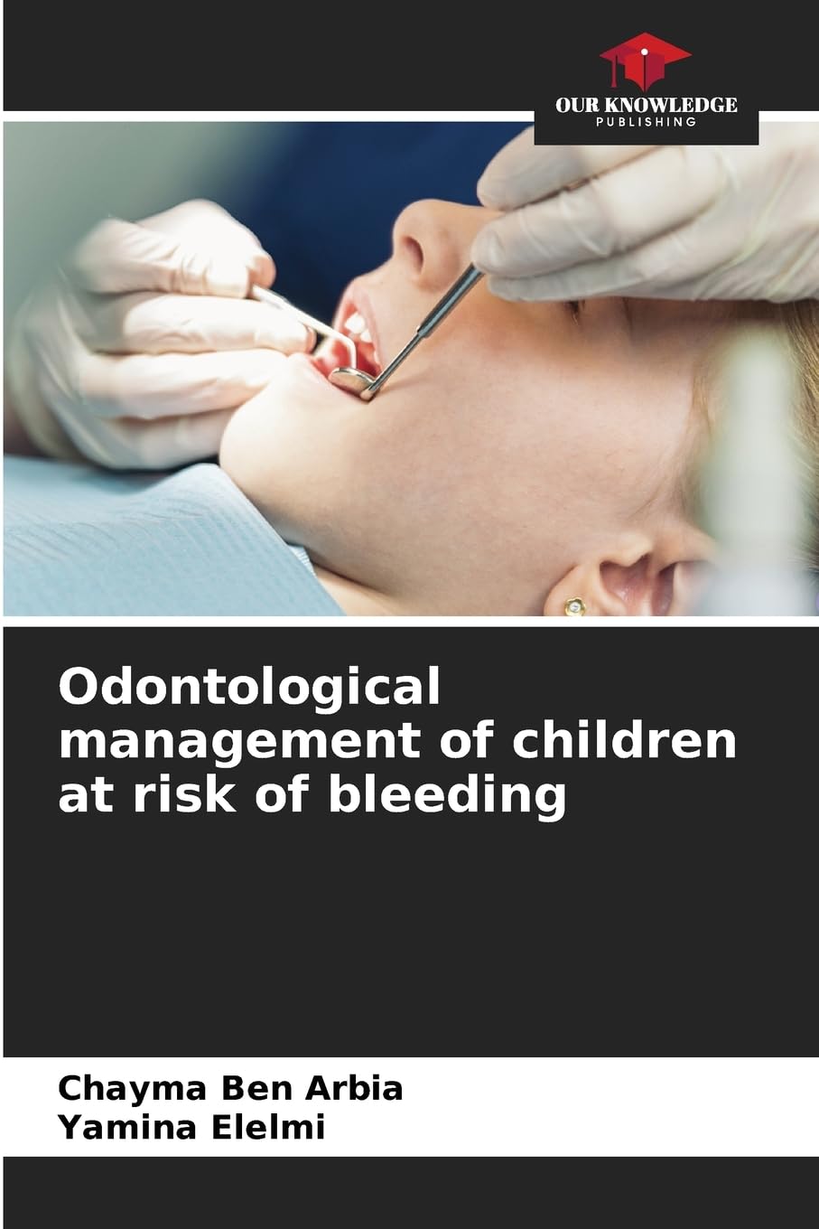 Odontological management of children at risk of bleeding Medicine