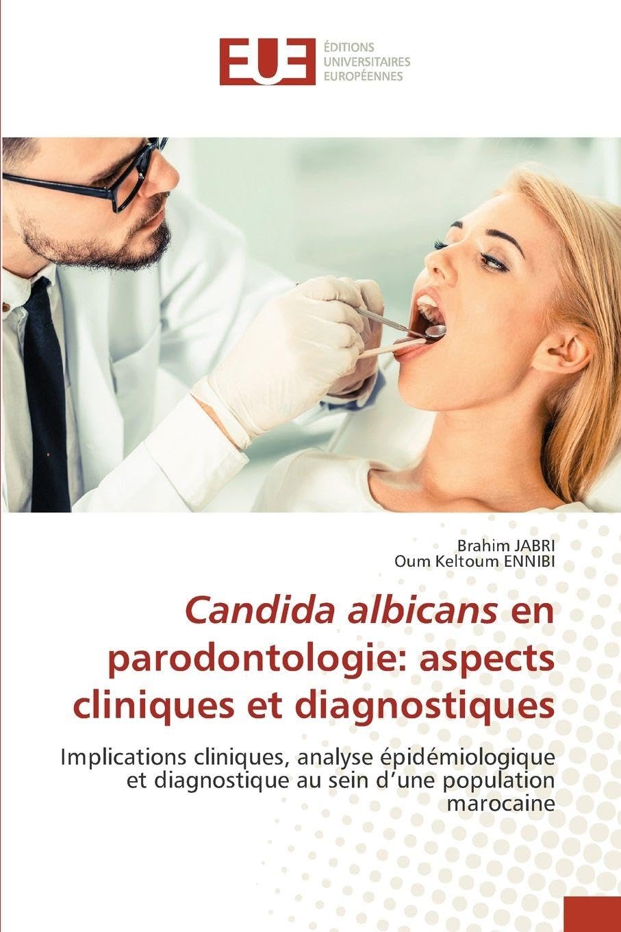 Candida albicans en parodontologie: aspects cliniques et diagnostiques Medicine