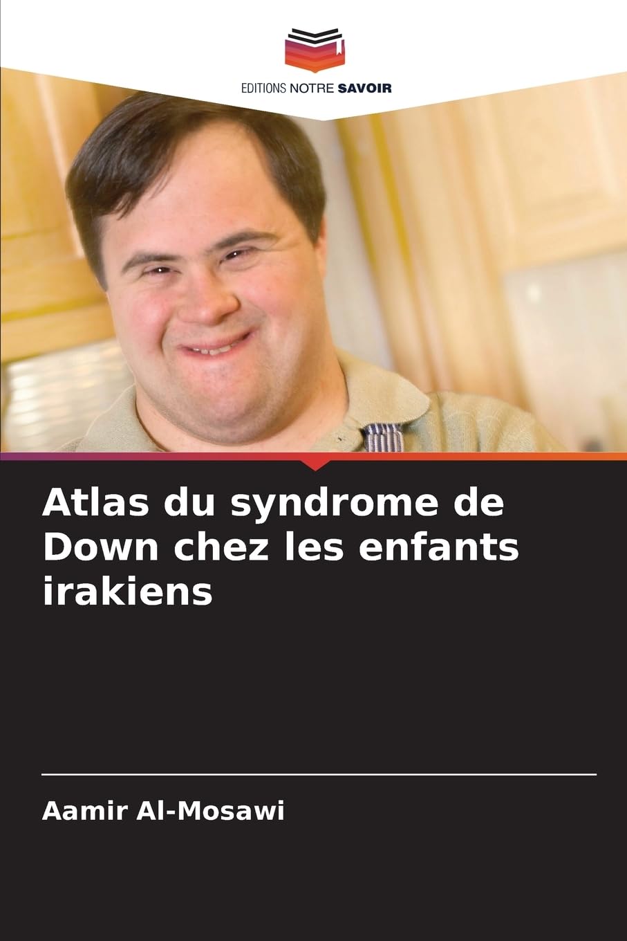 Atlas du syndrome de Down chez les enfants irakiens Medicine
