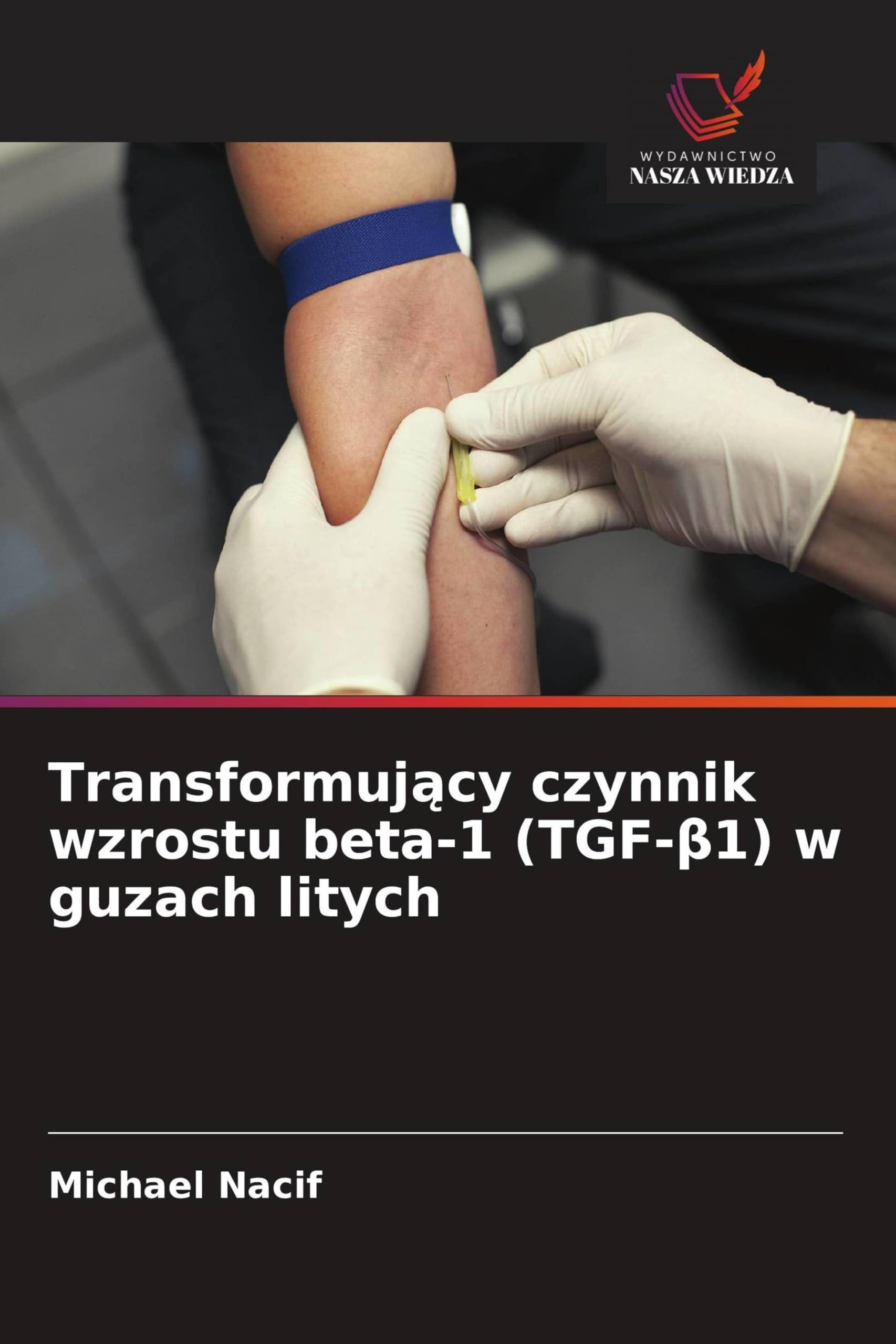 Transformuj¿cy czynnik wzrostu beta-1 (TGF-¿1) w guzach litych Medicine