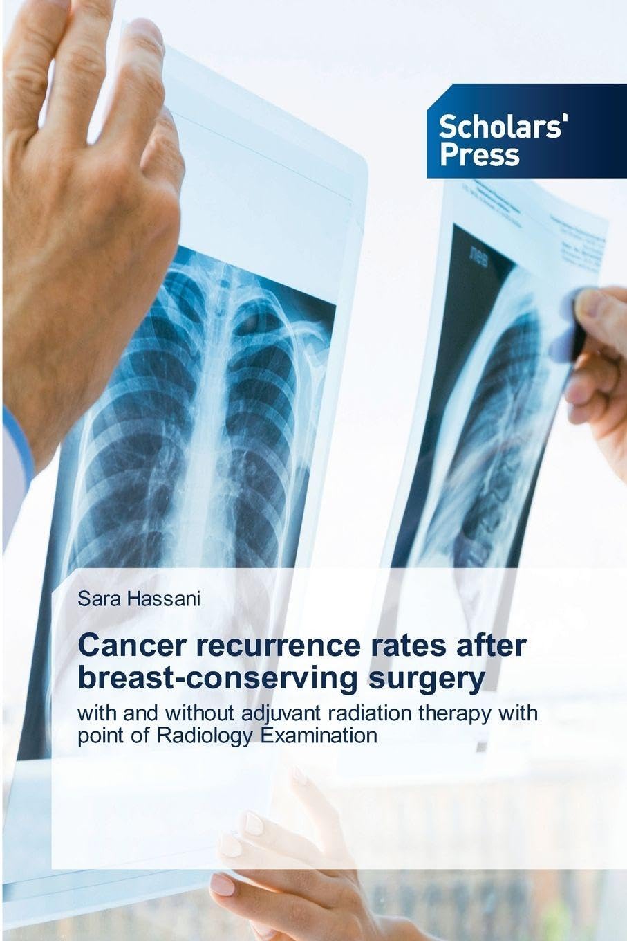 Cancer recurrence rates after breast-conserving surgery Medicine