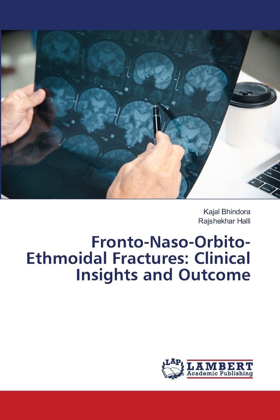 Fronto-Naso-Orbito-Ethmoidal Fractures: Clinical Insights and Outcome Medicine