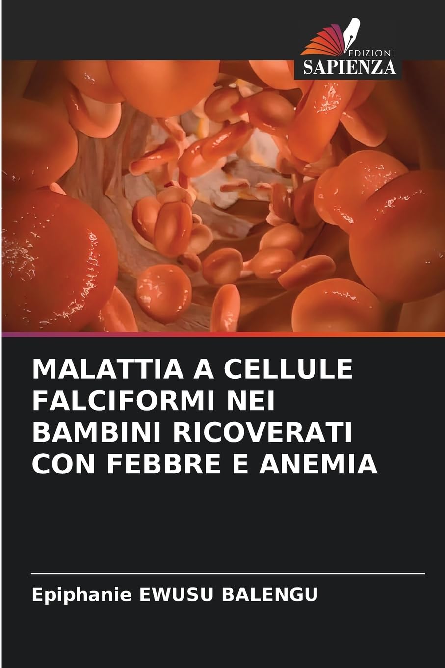 MALATTIA A CELLULE FALCIFORMI NEI BAMBINI RICOVERATI CON FEBBRE E ANEMIA Medicine