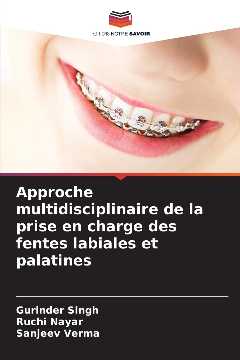 Approche multidisciplinaire de la prise en charge des fentes labiales et palatines Medicine