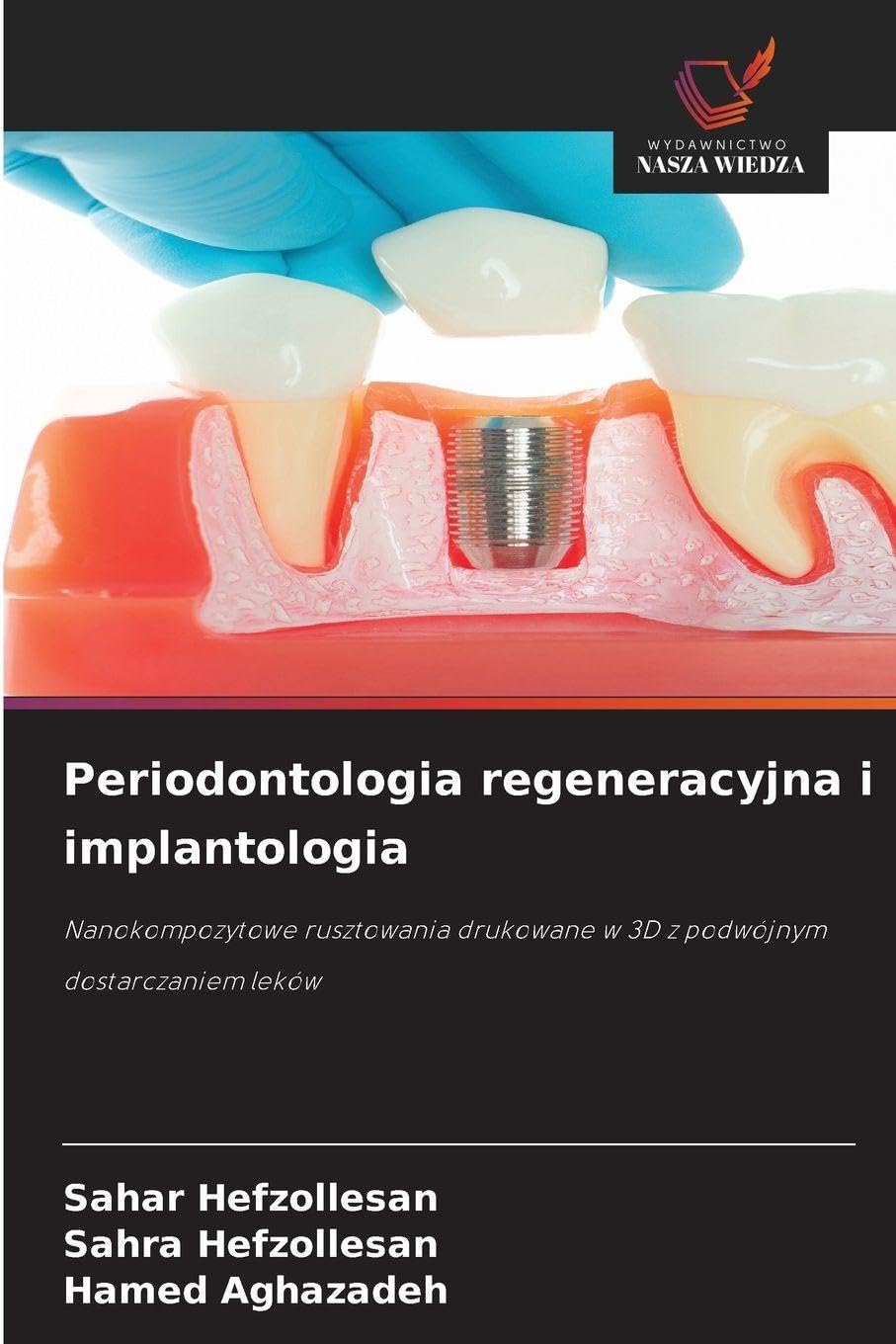 Periodontologia regeneracyjna i implantologia Medicine