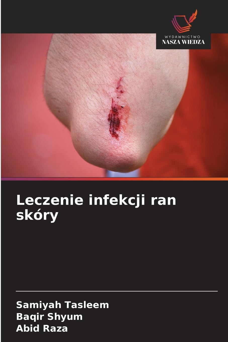 Leczenie infekcji ran skóry Medicine