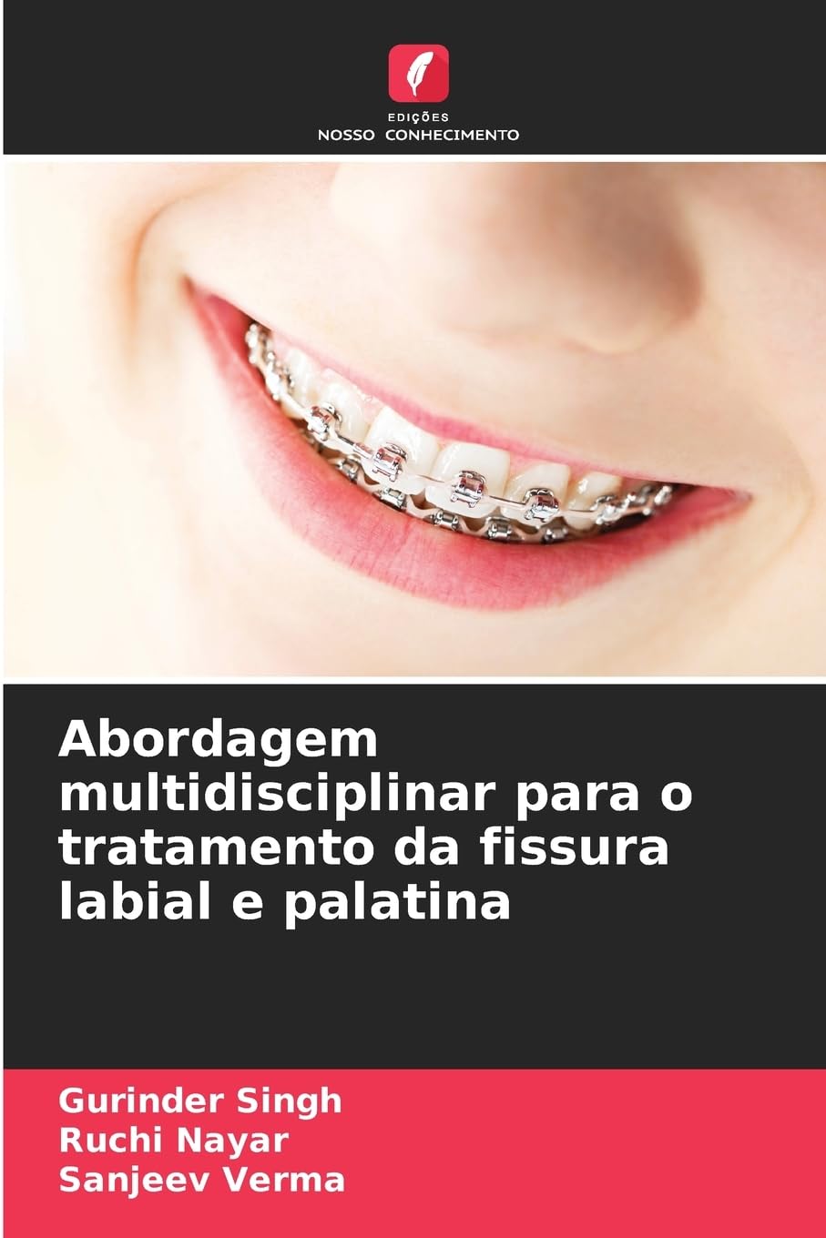 Abordagem multidisciplinar para o tratamento da fissura labial e palatina Medicine