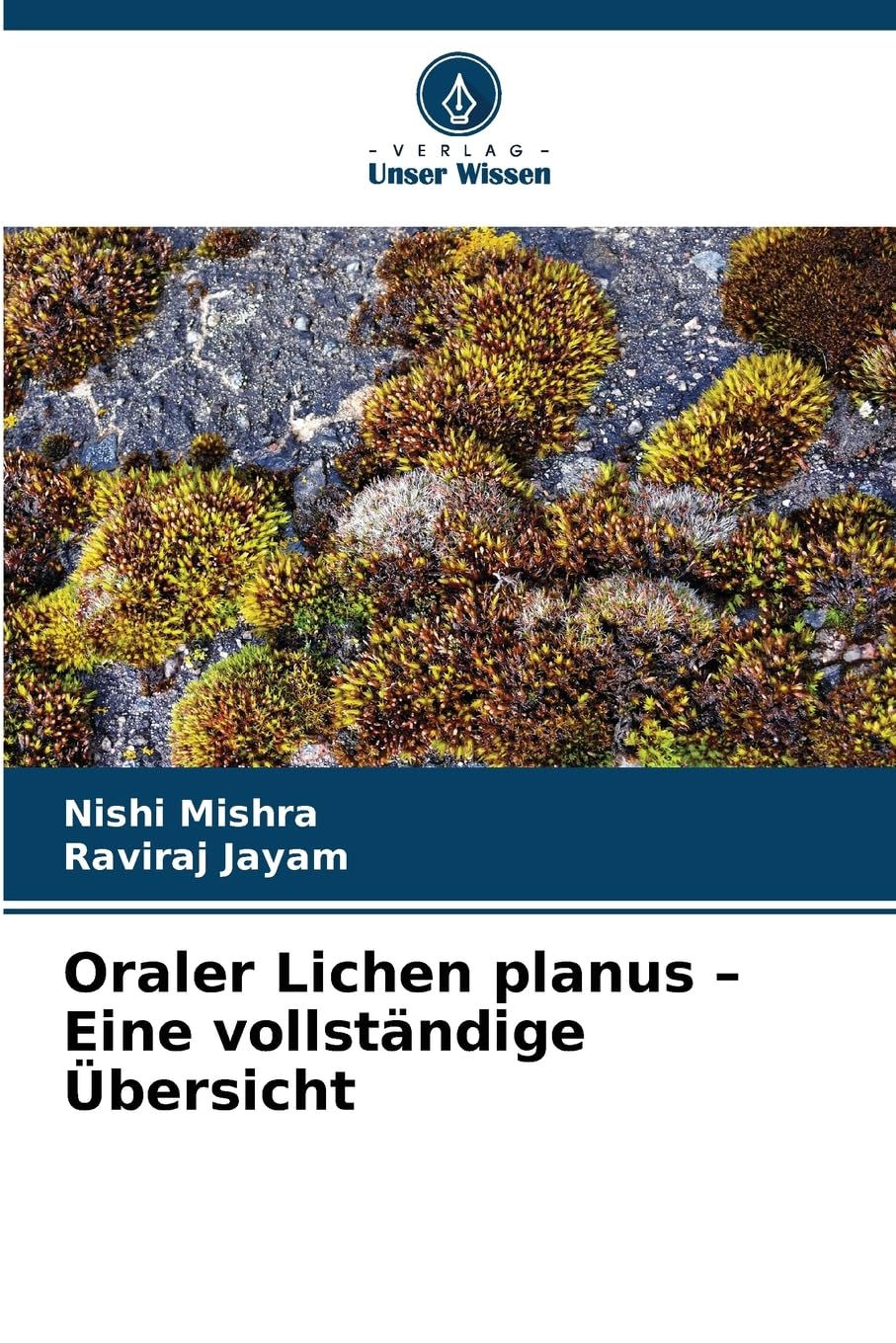 Oraler Lichen planus - Eine vollständige Übersicht Medicine