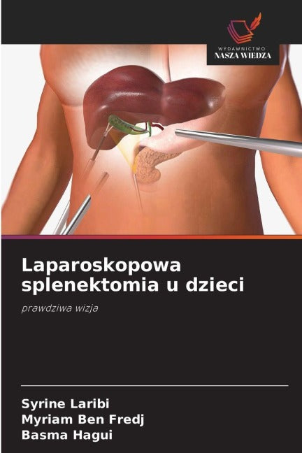 Laparoskopowa splenektomia u dzieci Books