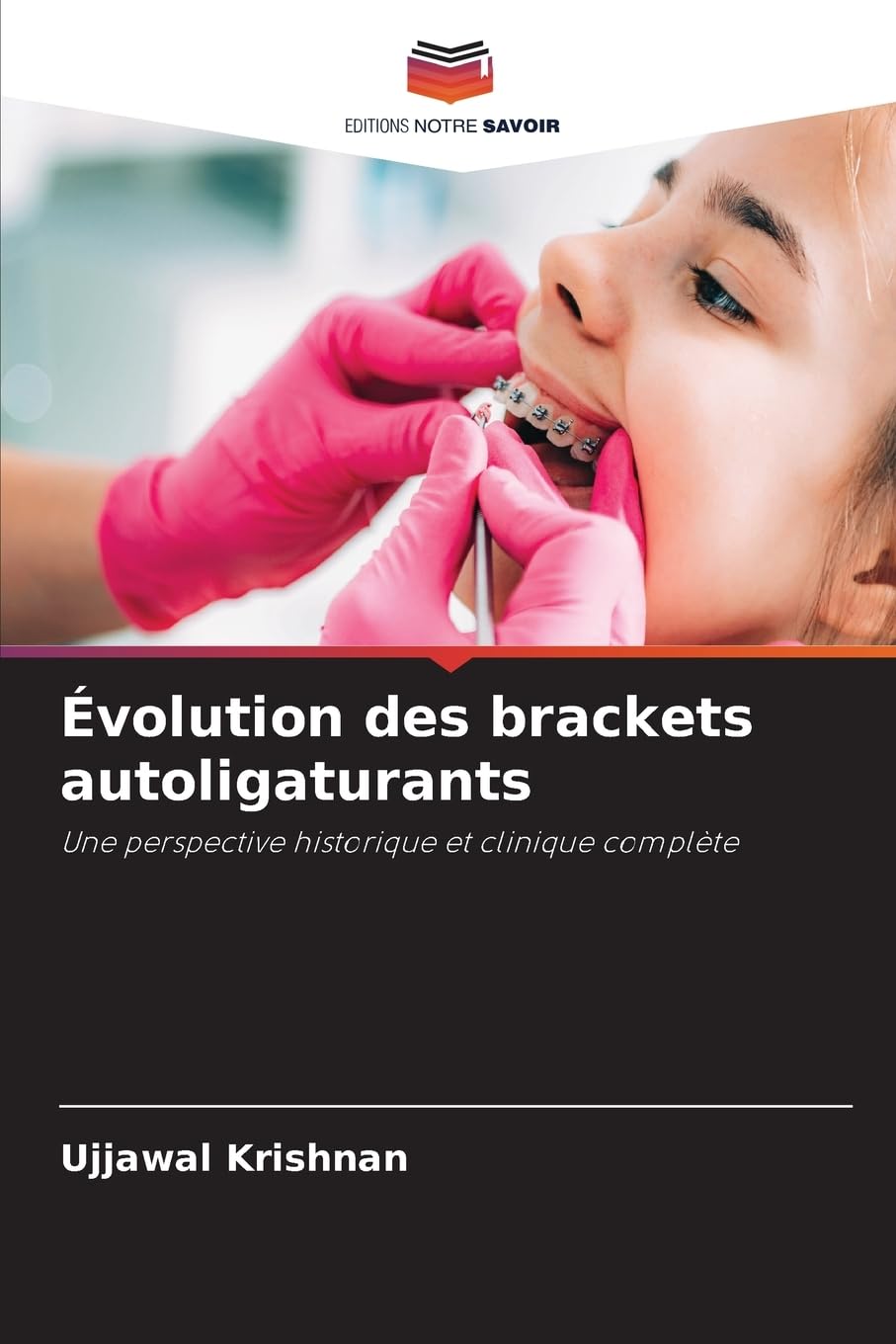 Évolution des brackets autoligaturants: Une perspective historique et clinique complète Medicine