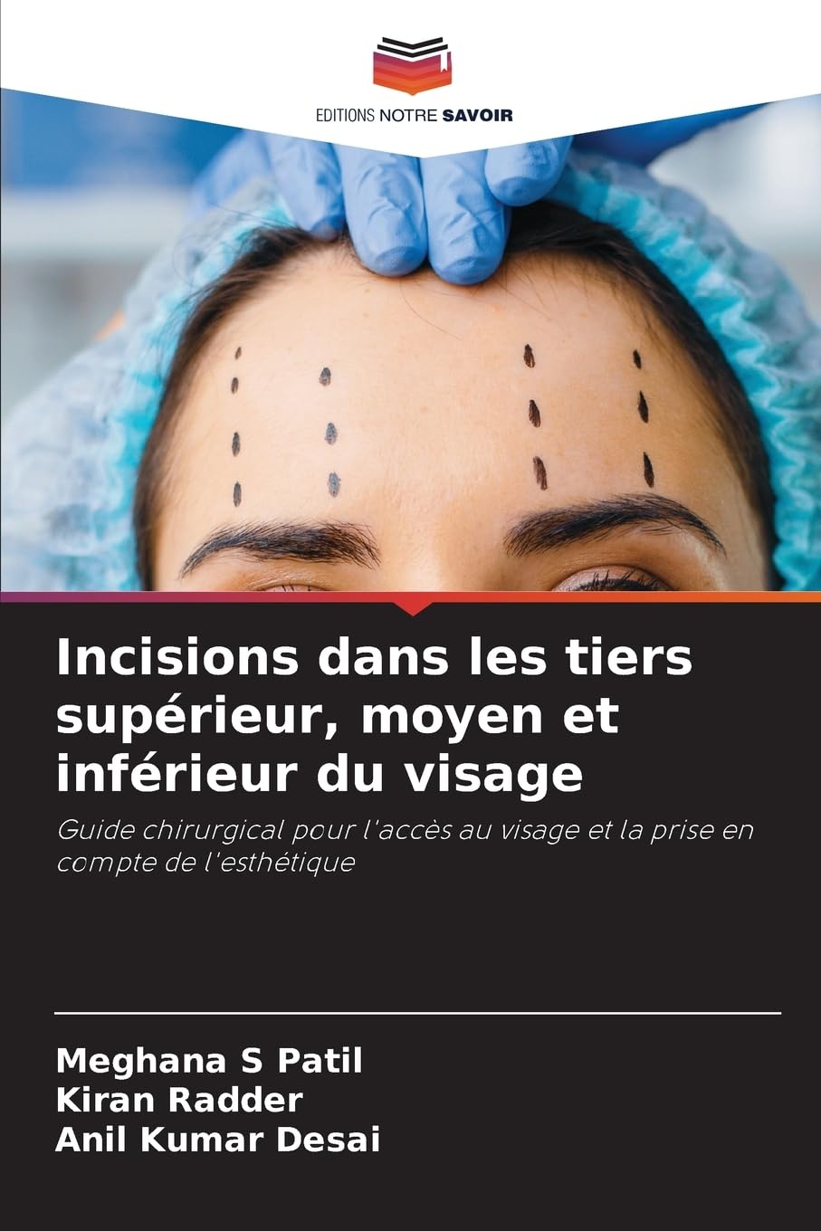 Incisions dans les tiers supérieur, moyen et inférieur du visage Medicine