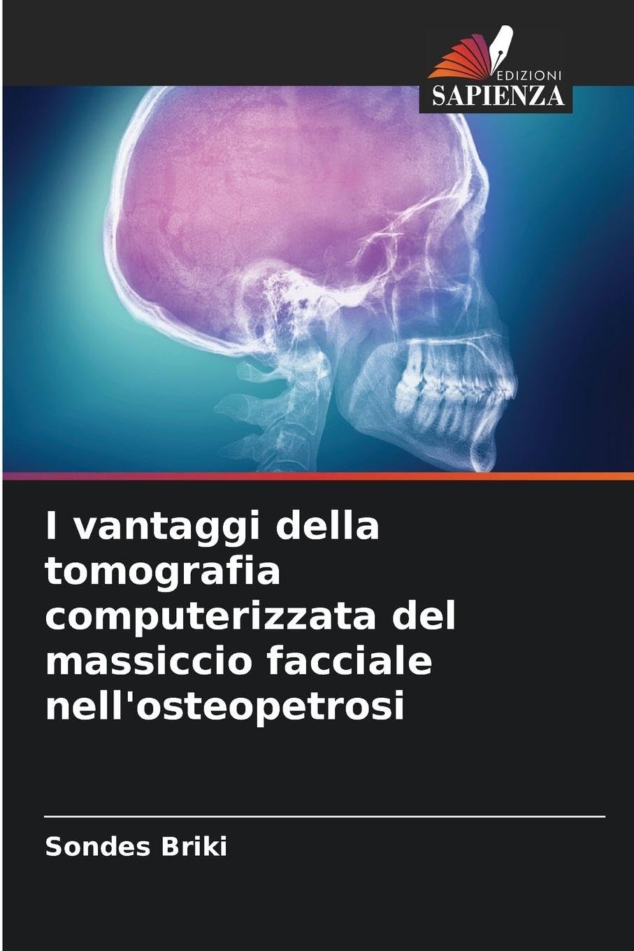I vantaggi della tomografia computerizzata del massiccio facciale nell'osteopetrosi Medicine
