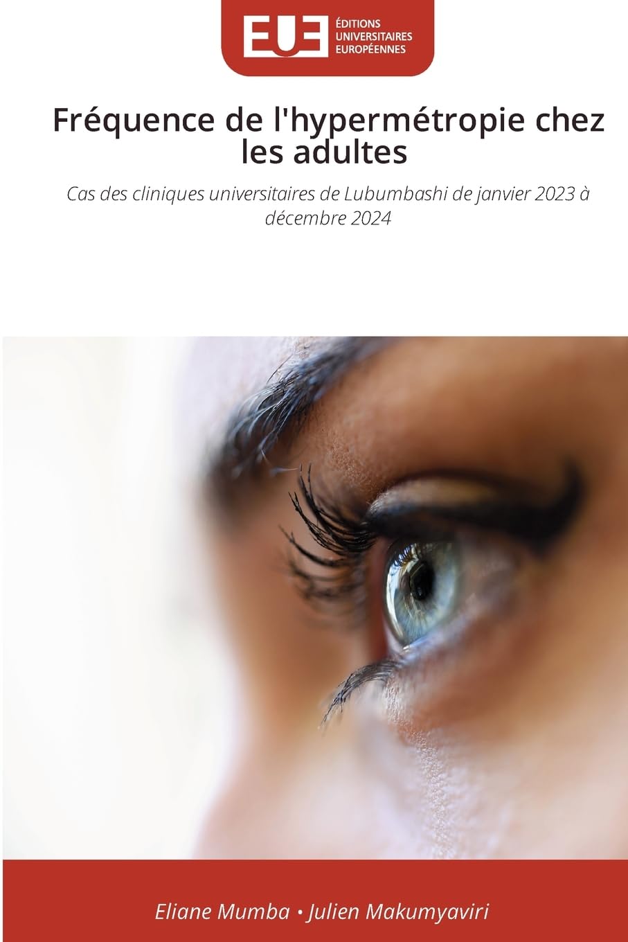 Fréquence de l'hypermétropie chez les adultes Medicine