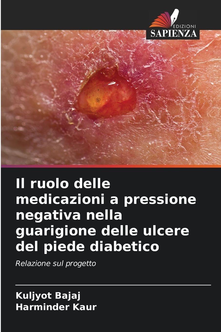 Il ruolo delle medicazioni a pressione negativa nella guarigione delle ulcere del piede diabetico Medicine