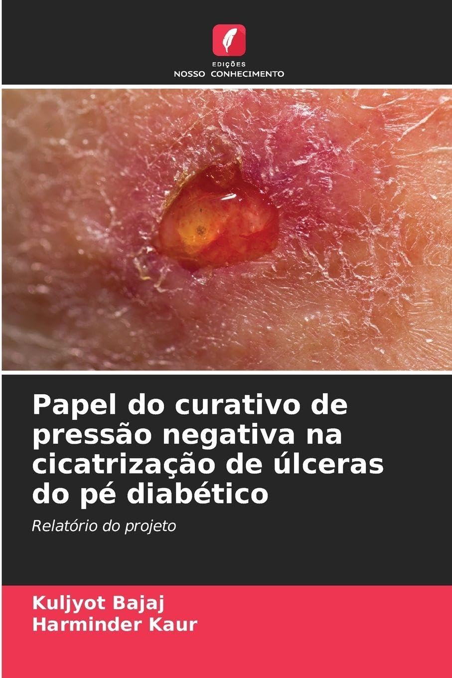 Papel do curativo de pressão negativa na cicatrização de úlceras do pé diabético Medicine