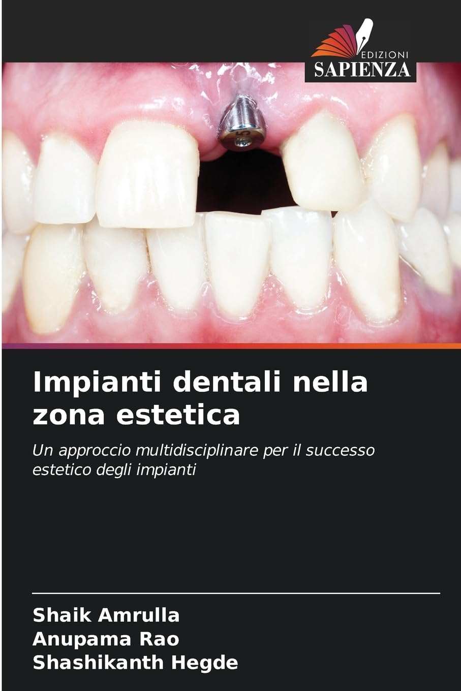 Impianti dentali nella zona estetica Medicine