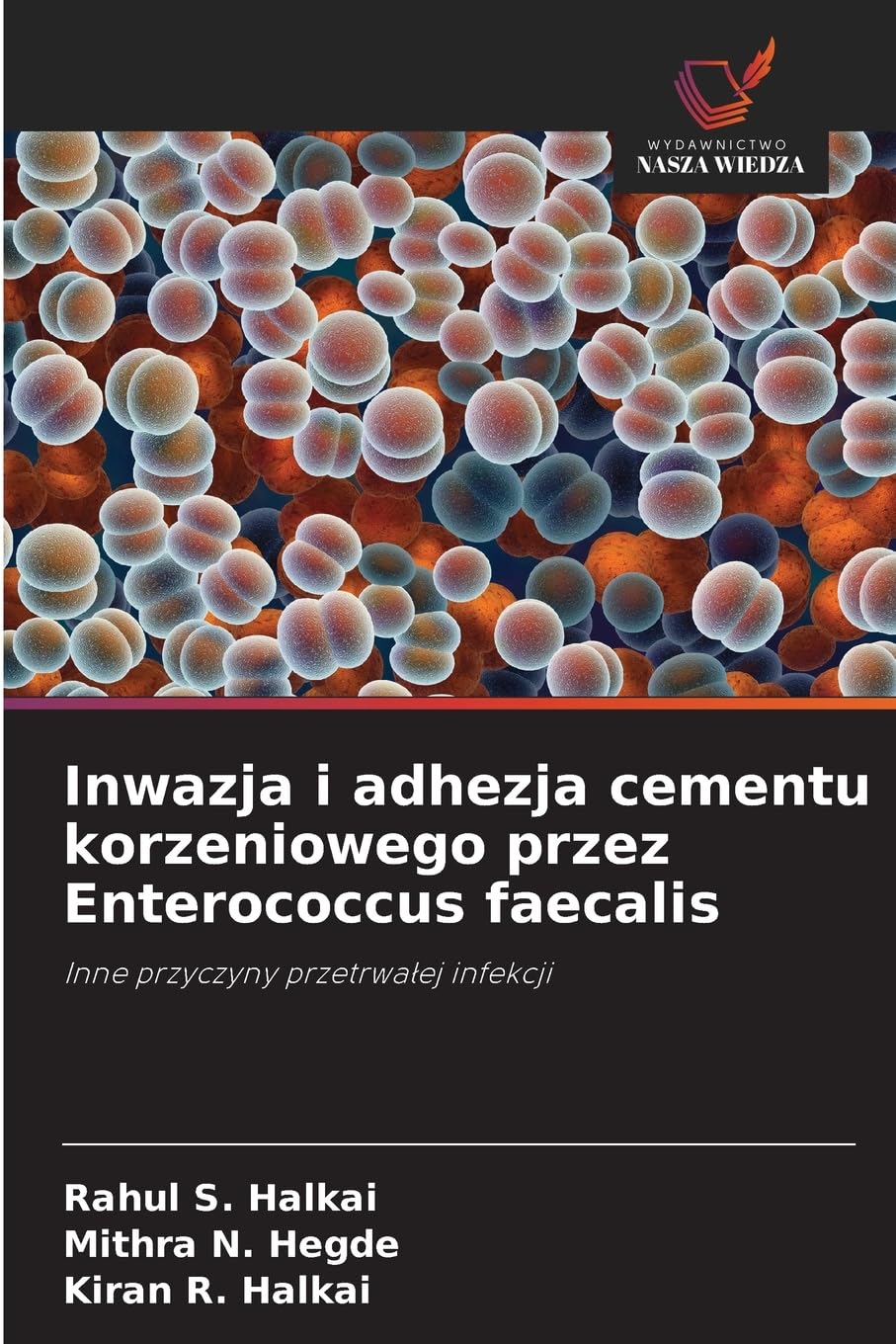 Inwazja i adhezja cementu korzeniowego przez Enterococcus faecalis Medicine