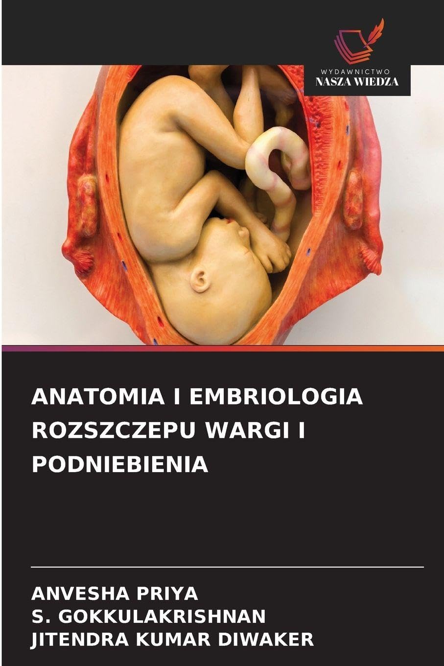 ANATOMIA I EMBRIOLOGIA ROZSZCZEPU WARGI I PODNIEBIENIA Medicine